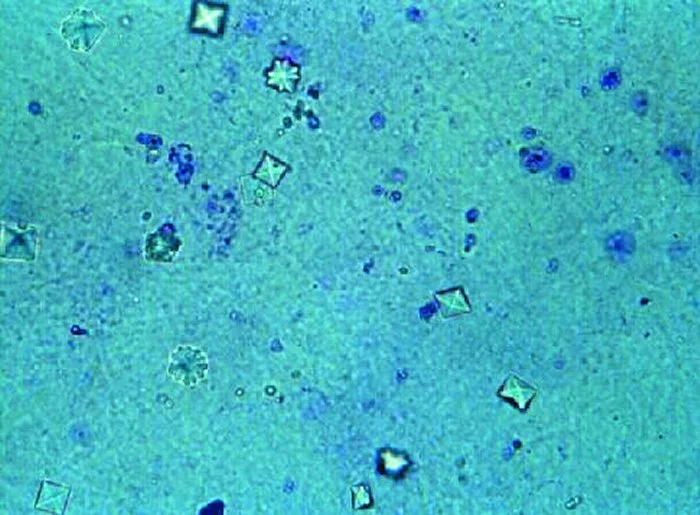 Mikroskopisches Urinsediment: Mehrere kleine, quadratische Kristalle mit diagonalem Kreuz, die wie Briefumschläge aussehen, zwischen blau angefärbten Zellen.
