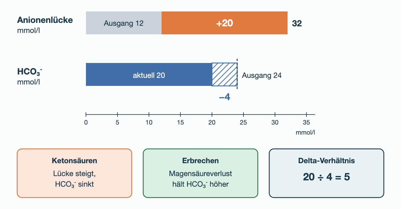 Balkenvergleich: Anionenlücke von 12 auf 32 mmol/l gestiegen (plus 20), HCO₃⁻ von 24 auf 20 mmol/l gefallen (minus 4); Delta-Verhältnis 20 ÷ 4 = 5.