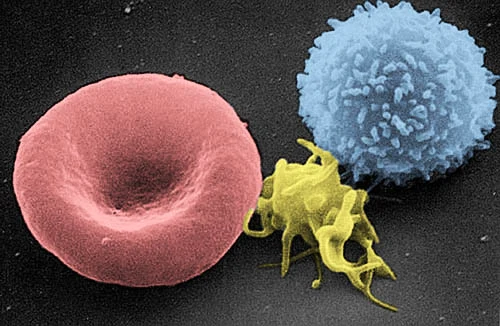 Eingefärbte rasterelektronenmikroskopische Aufnahme: links ein rot eingefärbter, scheibenförmiger Erythrozyt mit zentraler Eindellung, in der Mitte ein gelber Thrombozyt, rechts ein blauer Leukozyt.
