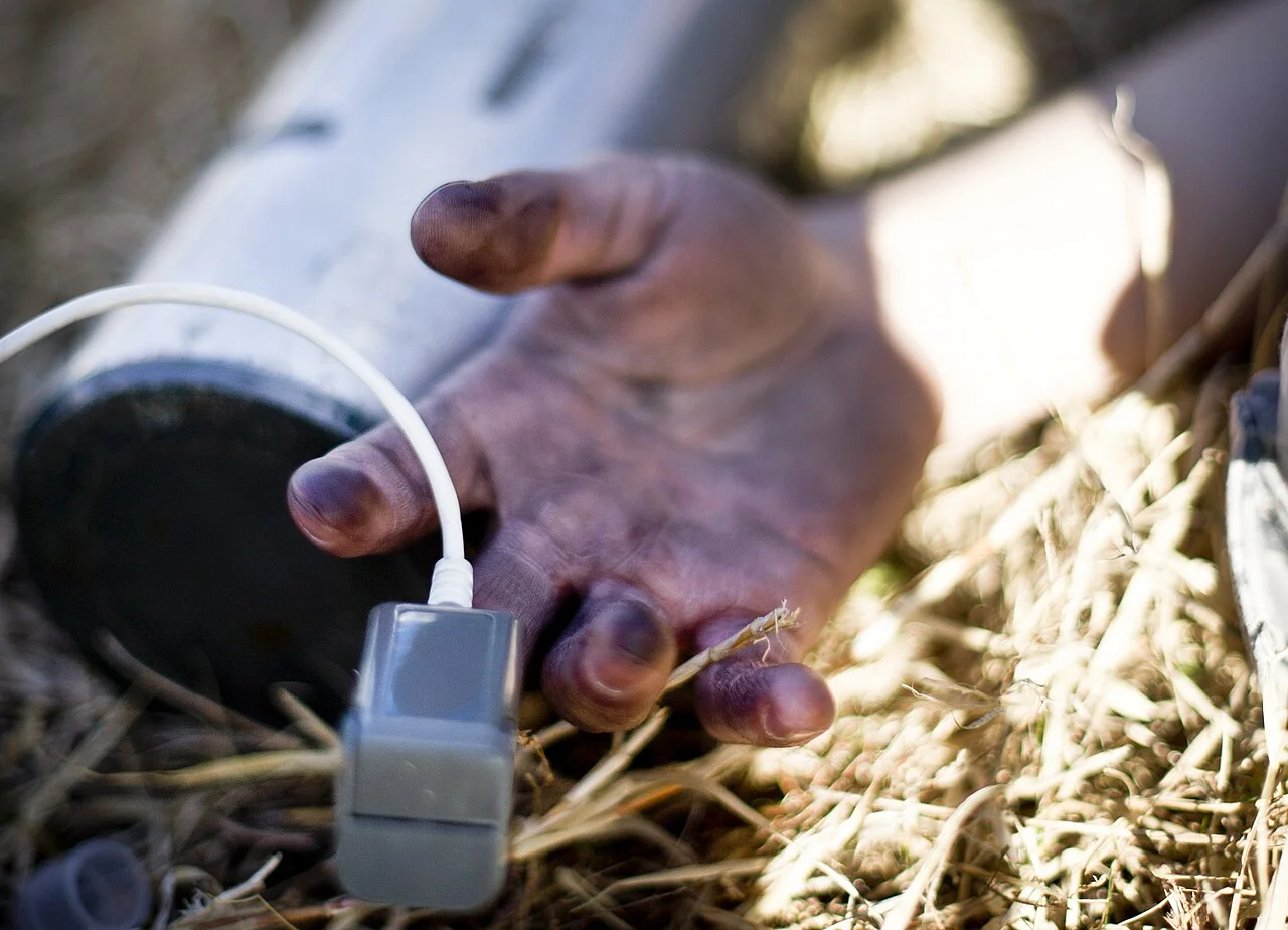 Geschminkte, verschmutzte Hand einer liegenden Übungsperson im trockenen Gras; an einem Finger sitzt ein grauer Fingerclip-Sensor mit weißem Kabel.