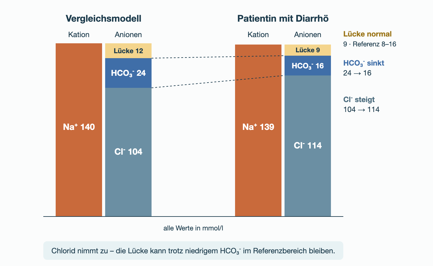Säulenvergleich in mmol/l: Vergleichsmodell Na⁺ 140 gegen Cl⁻ 104, HCO₃⁻ 24 und Lücke 12; Patientin mit Diarrhö Na⁺ 139 gegen Cl⁻ 114, HCO₃⁻ 16 und Lücke 9.