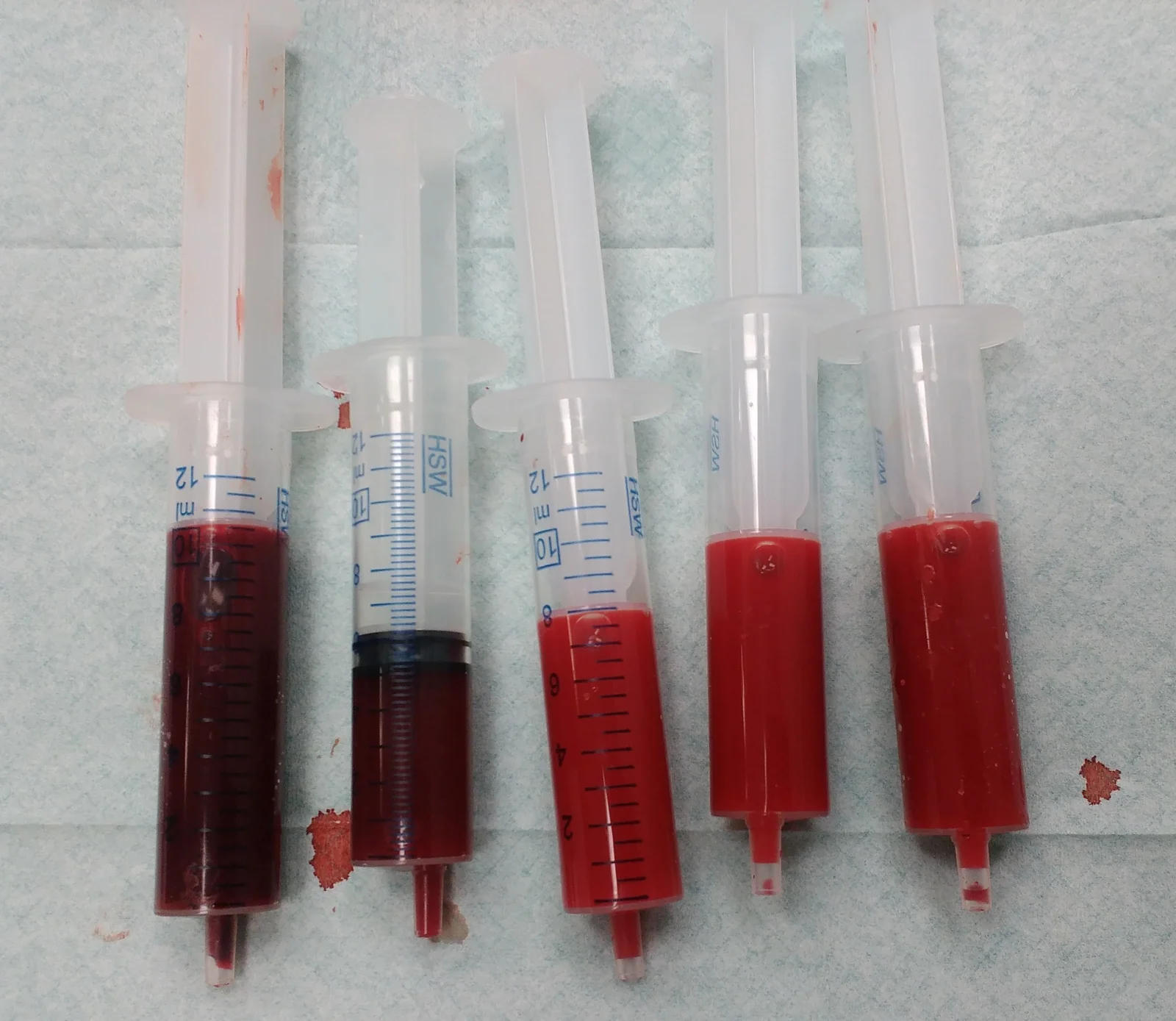 Fünf Spritzen mit Blut auf einer Unterlage: links zwei mit dunklerem, rechts drei mit hellerem Blut.
