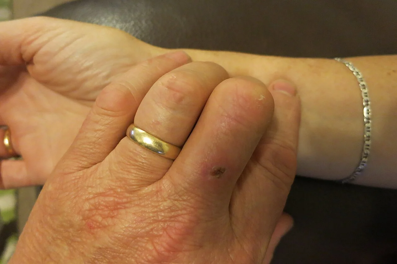 Zwei Finger einer Hand liegen auf der Beugeseite des Handgelenks einer anderen Person, daumenseitig über der Speiche.