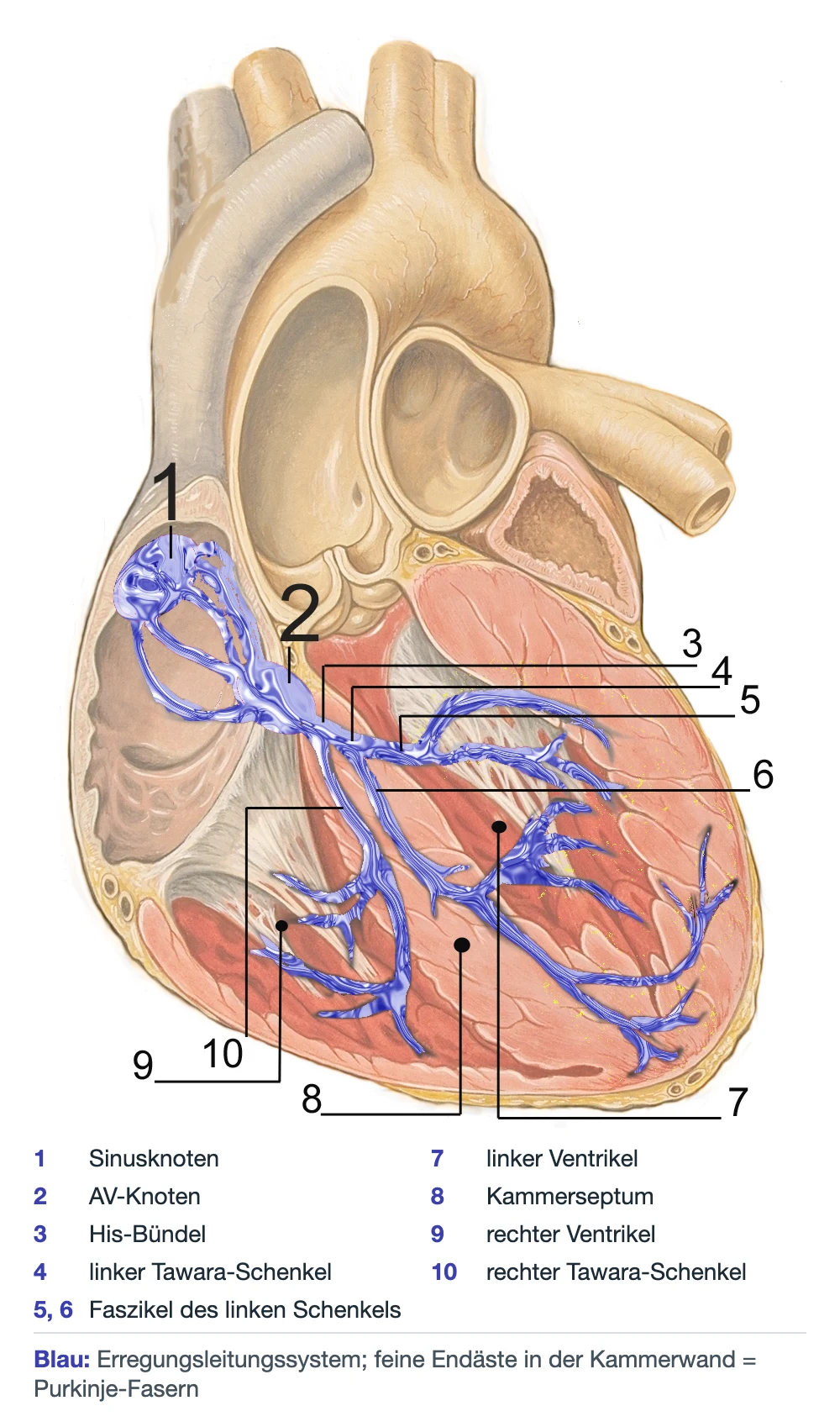 Anatomische Illustration eines eröffneten Herzens von vorn mit blau hervorgehobenem Erregungsleitungssystem und nummerierter deutscher Legende: 1 Sinusknoten, 2 AV-Knoten, 3 His-Bündel, 4 linker Tawara-Schenkel, 5 und 6 Faszikel des linken Schenkels, 7 linker Ventrikel, 8 Kammerseptum, 9 rechter Ventrikel, 10 rechter Tawara-Schenkel; die feinen blauen Endäste in der Kammerwand sind Purkinje-Fasern.