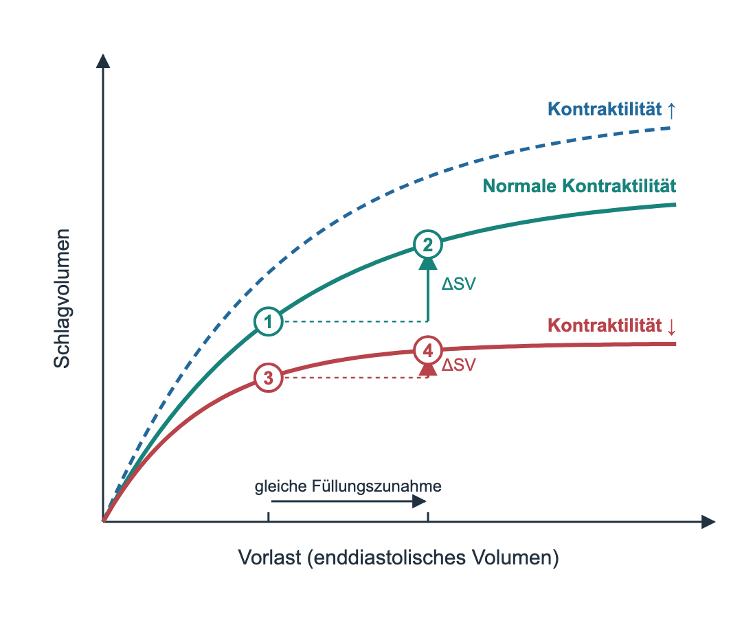 Frank-Starling-Kurven. Waagerechte Achse Vorlast als enddiastolisches Volumen, senkrechte Achse Schlagvolumen. Drei ansteigende, nach rechts abflachende Kurven: oben gestrichelt Kontraktilität erhöht, in der Mitte normale Kontraktilität, unten Kontraktilität vermindert mit frühem flachem Verlauf. Auf der mittleren Kurve führt eine Füllungszunahme von Punkt 1 nach Punkt 2 zu einem deutlichen Anstieg des Schlagvolumens; auf der unteren Kurve führt dieselbe Füllungszunahme von Punkt 3 nach Punkt 4 nur zu einem kleinen Anstieg.
