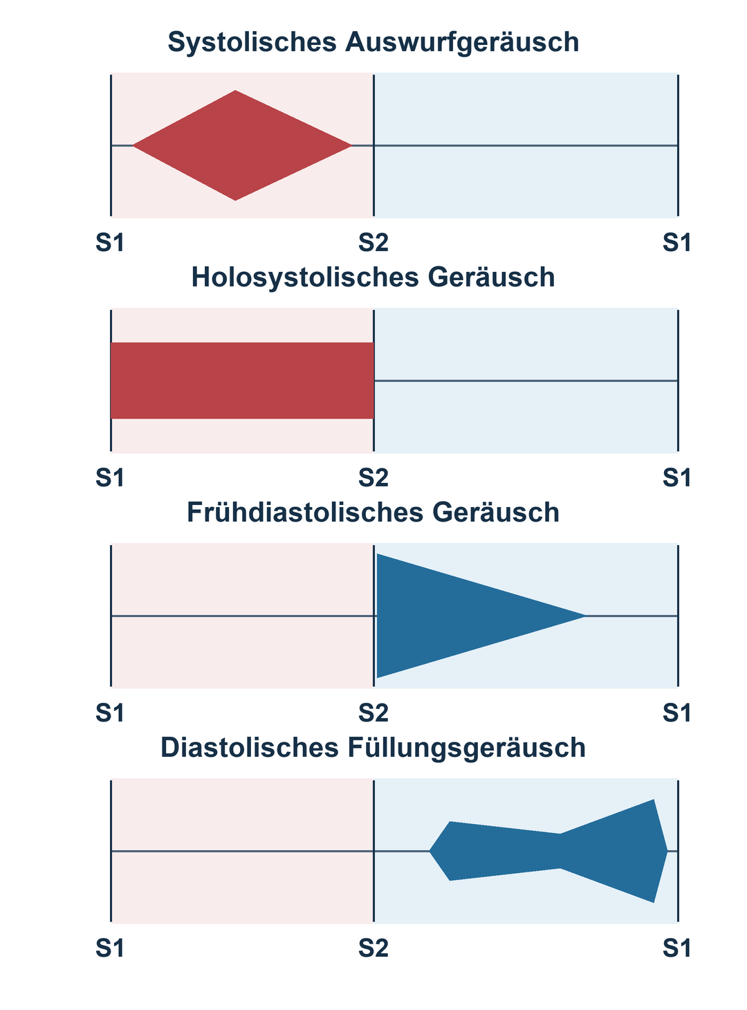Zeitliche Formen von systolischem Auswurfgeräusch, Holosystolikum und diastolischen Geräuschen.
