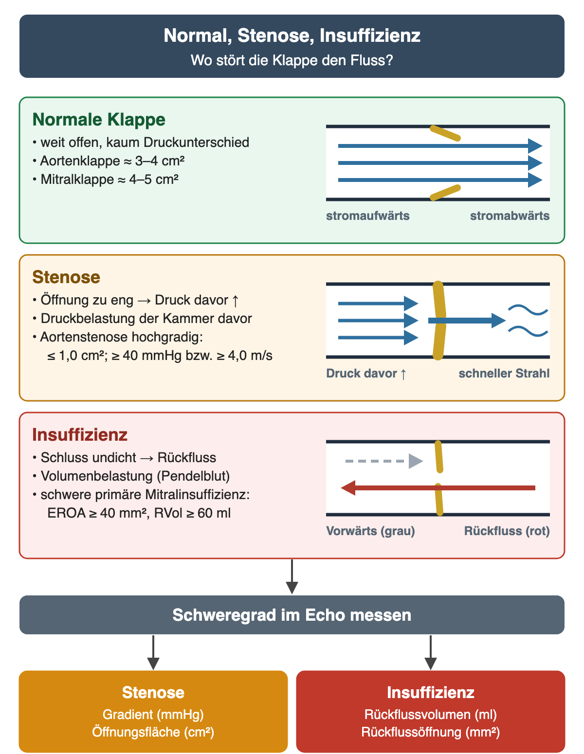 Drei Zeilen untereinander, jeweils links Stichpunkte und rechts ein Gefäßabschnitt mit Klappe. Normale Klappe in Grün: weit offen, kaum Druckunterschied, Aortenklappe etwa 3–4 cm², Mitralklappe etwa 4–5 cm²; drei gleich lange Flusspfeile. Stenose in Orange: Öffnung zu eng, Druck davor steigt, Druckbelastung der Kammer davor; hochgradige Aortenstenose bei höchstens 1,0 cm² und mindestens 40 mmHg beziehungsweise 4,0 m/s; Flusspfeile stauen sich vor der dicken, engen Klappe, dahinter ein schneller Strahl mit Wirbeln. Insuffizienz in Rot: Schluss undicht, Rückfluss, Volumenbelastung durch Pendelblut; schwere primäre Mitralinsuffizienz bei EROA mindestens 40 mm² und Rückflussvolumen mindestens 60 ml; grauer gestrichelter Vorwärtspfeil und roter Rückflusspfeil durch die nicht dicht schließende Klappe. Unten: Schweregrad im Echo messen, bei Stenose Gradient und Öffnungsfläche, bei Insuffizienz Rückflussvolumen und Rückflussöffnung.