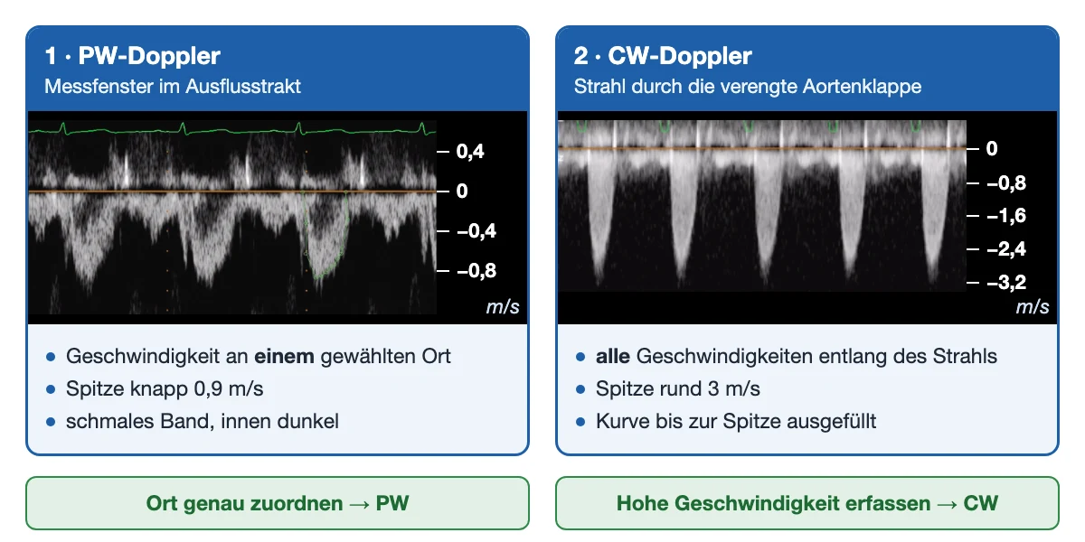 Zwei echte Dopplerspektren nebeneinander, beide mit deutscher Geschwindigkeitsskala in m/s. Links der gepulste Doppler im Ausflusstrakt: ein schmales helles Band unter der Nulllinie, innen dunkel, Spitze knapp unter 0,9 m/s, ein Schlag grün nachgezeichnet. Rechts der kontinuierliche Doppler durch eine verengte Aortenklappe: spitz zulaufende, bis zur Spitze ausgefüllte Kurven unter der Nulllinie bis etwa 3 m/s. Darunter je drei Stichpunkte und die Merksätze „Ort genau zuordnen – PW“ und „Hohe Geschwindigkeit erfassen – CW“.