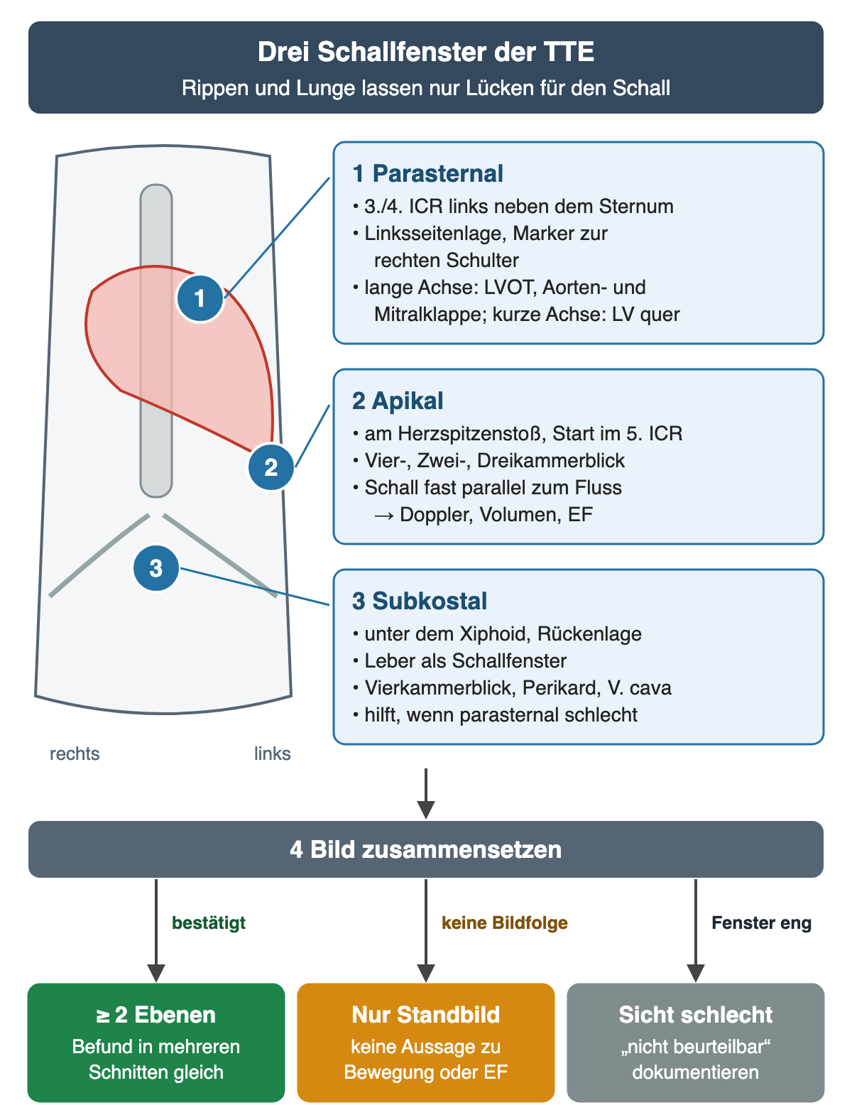 Links ein Rumpf von vorn mit Brustbein, Herz und Rippenbogen; drei nummerierte Punkte markieren die Schallkopflage: 1 links neben dem Brustbein, 2 an der Herzspitze, 3 unter dem Xiphoid. Rechts drei blaue Kästen: 1 parasternal im 3./4. Interkostalraum in Linksseitenlage mit langer und kurzer Achse, 2 apikal am Herzspitzenstoß ab dem 5. Interkostalraum mit Vier-, Zwei- und Dreikammerblick, 3 subkostal mit Leber als Schallfenster, Perikard und V. cava. Darunter führt „Bild zusammensetzen“ zu drei Ergebnissen: grün mindestens zwei Ebenen, orange nur Standbild, grau „nicht beurteilbar“ bei schlechter Sicht.