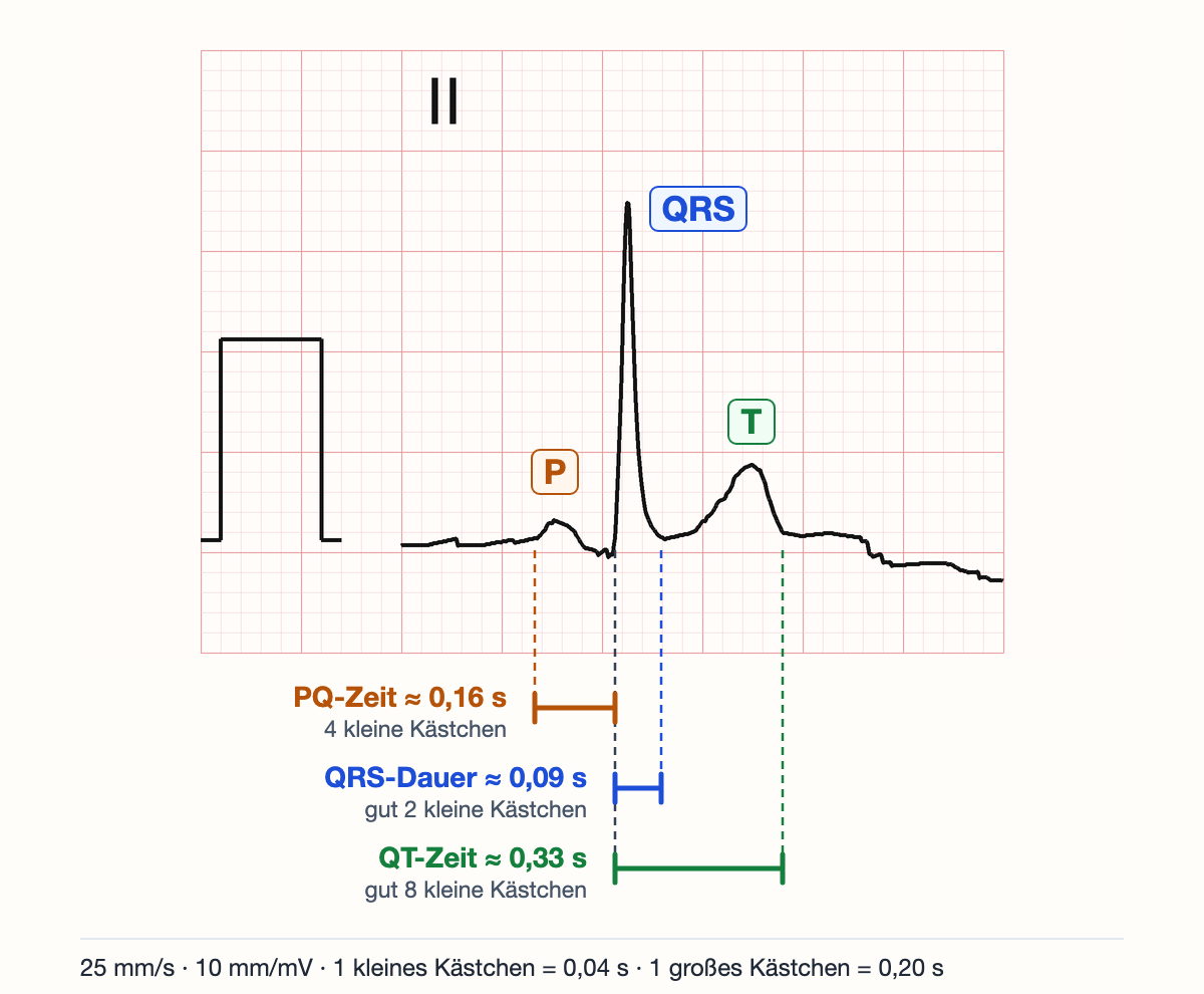 Vergrößerter echter Herzschlag in Ableitung II auf EKG-Papier mit Kalibrierungszacke. Über den Wellen stehen die Markierungen P, QRS und T. Gestrichelte Linien führen von P-Beginn, QRS-Beginn, QRS-Ende und T-Ende nach unten zu drei Messklammern: PQ-Zeit etwa 0,16 s (4 kleine Kästchen), QRS-Dauer etwa 0,09 s (gut 2 kleine Kästchen) und QT-Zeit etwa 0,33 s (gut 8 kleine Kästchen); QRS-Dauer und QT-Zeit beginnen an derselben Linie.