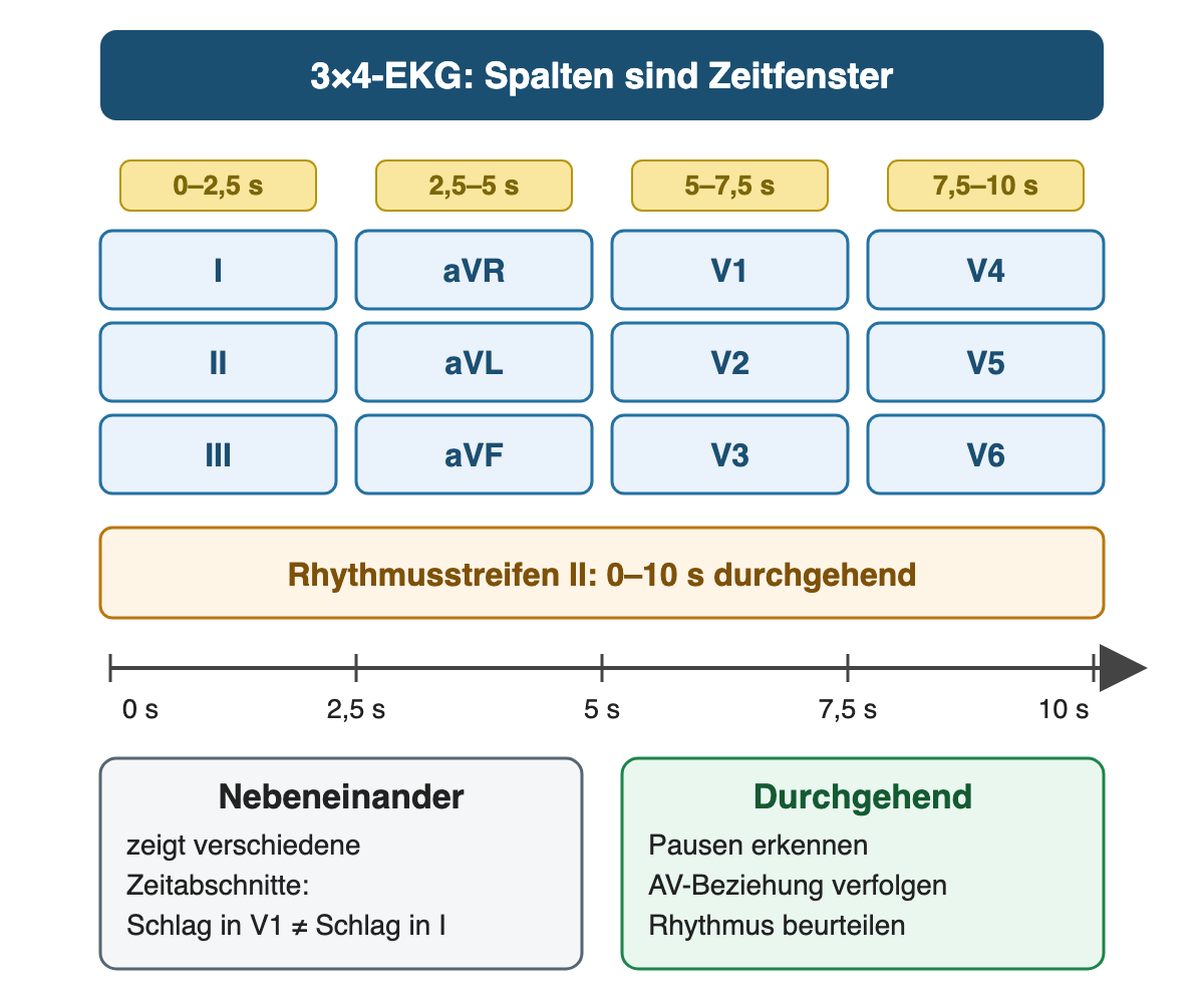 3×4-Anordnung: I, II, III von 0 bis 2,5 s, aVR, aVL, aVF von 2,5 bis 5 s, V1 bis V3 von 5 bis 7,5 s, V4 bis V6 von 7,5 bis 10 s; darunter Rhythmusstreifen II von 0 bis 10 s für Pausen, AV-Beziehung und Rhythmus