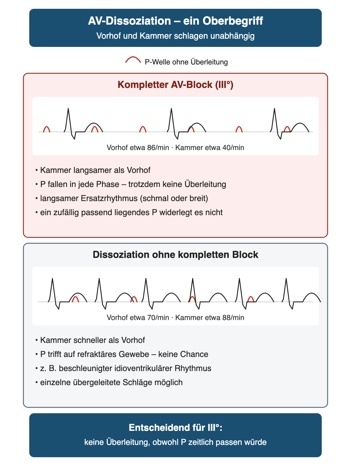Vergleich zweier schematischer Rhythmusstreifen: oben kompletter AV-Block mit Vorhof etwa 86 pro Minute und Kammer etwa 40 pro Minute, unten AV-Dissoziation mit schnellerem Kammerrhythmus etwa 88 pro Minute und langsameren P-Wellen etwa 70 pro Minute