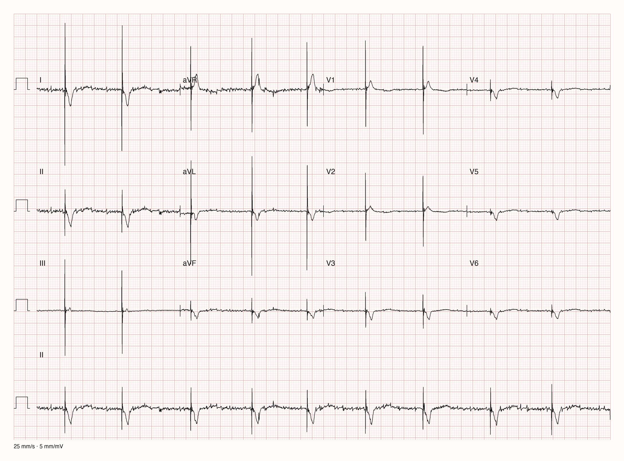 12-Kanal-EKG E00831; zur systematischen Befundung