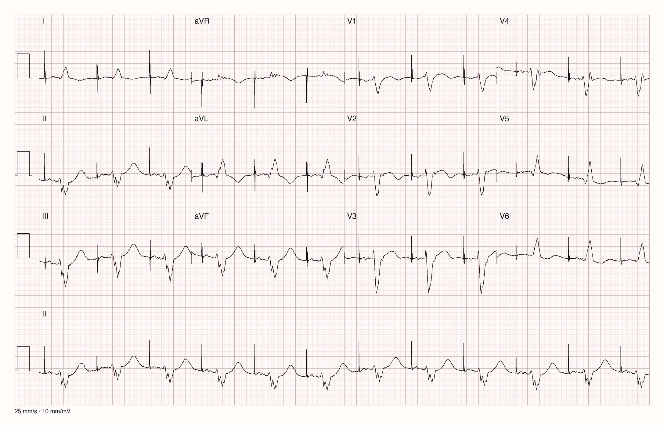 12-Kanal-EKG E00852; zur systematischen Befundung