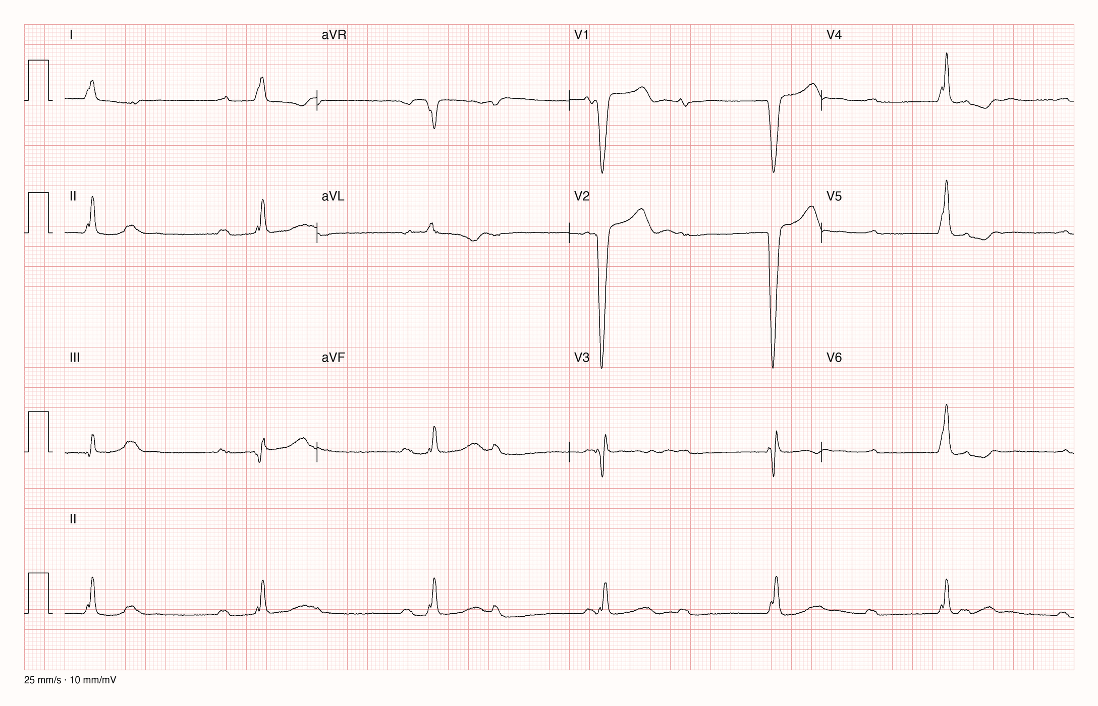 12-Kanal-EKG E09423; zur systematischen Befundung