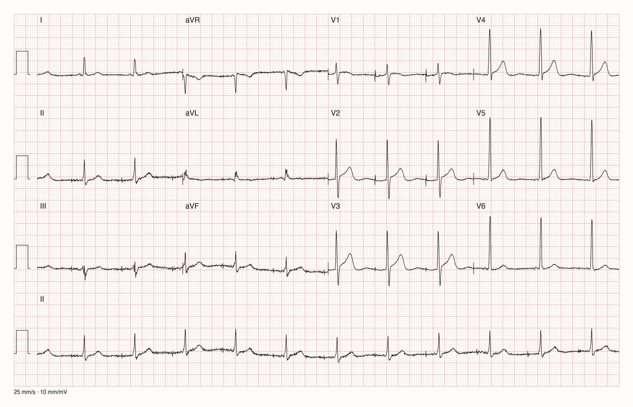 12-Kanal-EKG E10339; zur systematischen Befundung