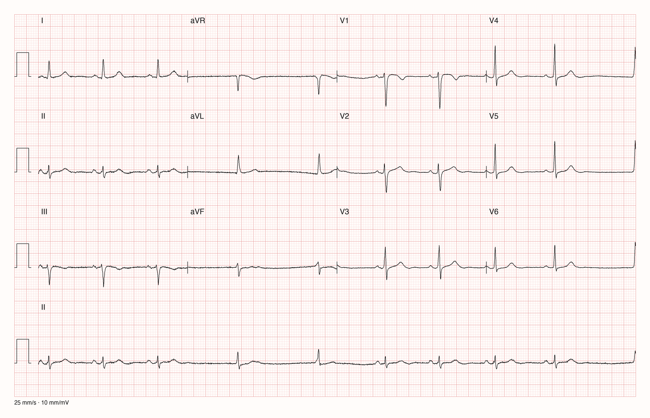 12-Kanal-EKG JS06588; zur systematischen Befundung