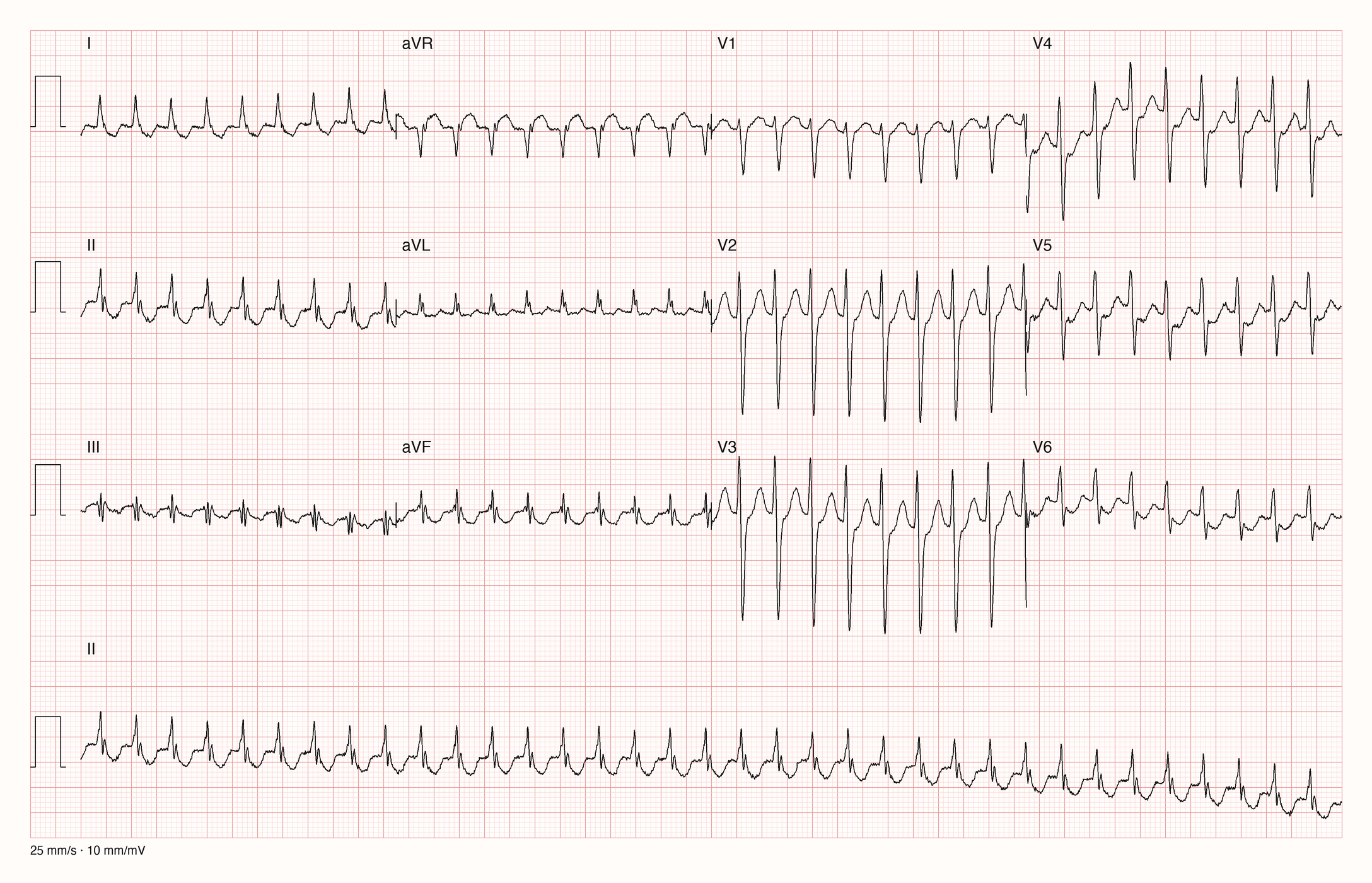 12-Kanal-EKG JS10306; zur systematischen Befundung