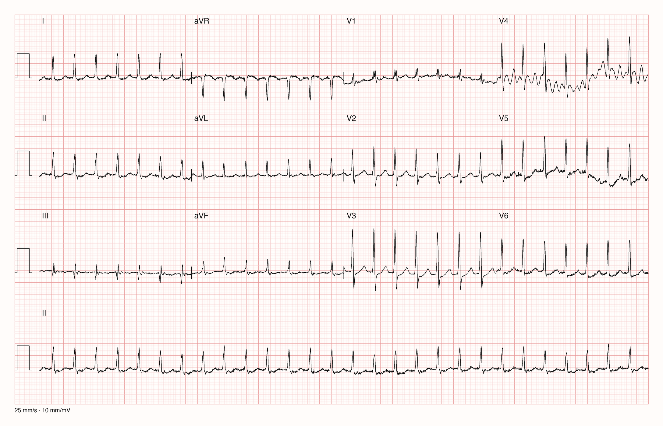 12-Kanal-EKG JS10350; zur systematischen Befundung