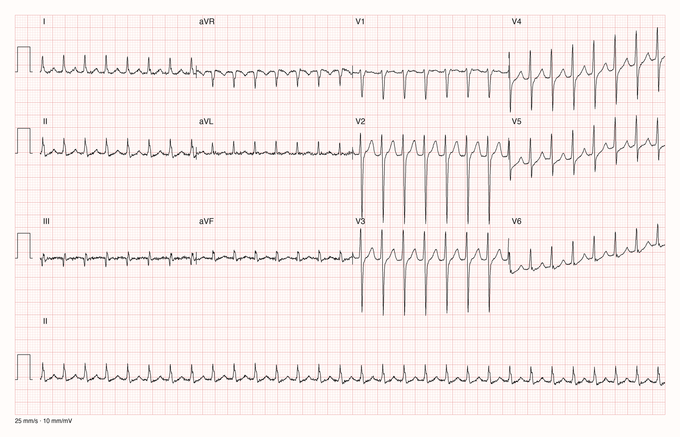 12-Kanal-EKG JS10361; zur systematischen Befundung