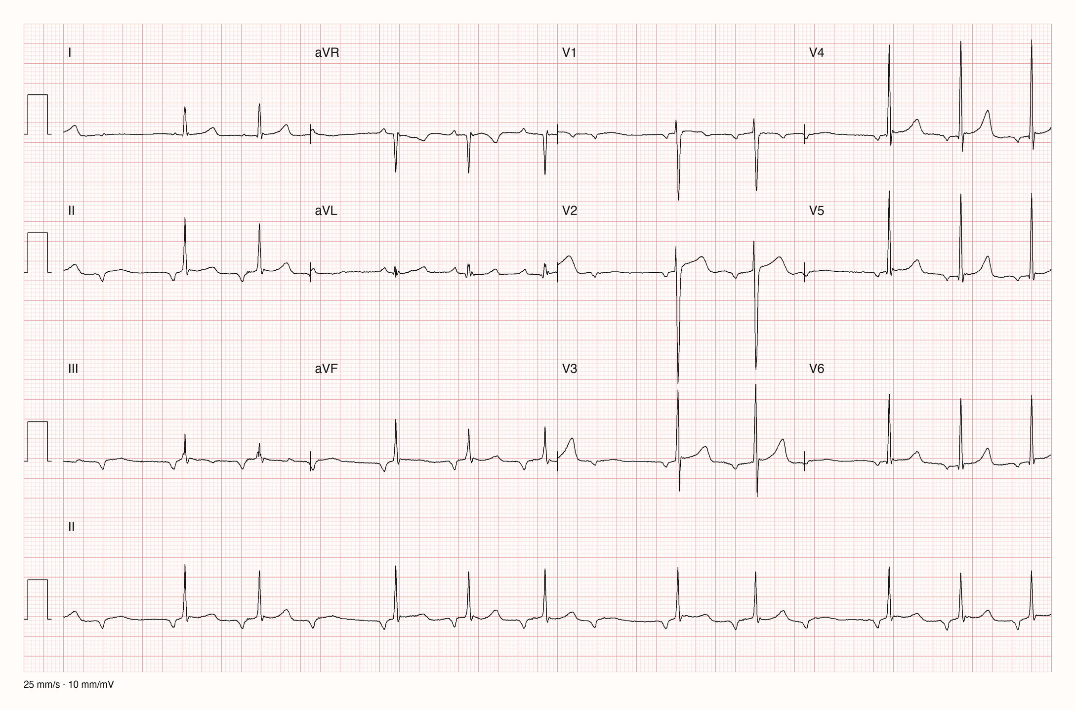 12-Kanal-EKG JS12420; zur systematischen Befundung