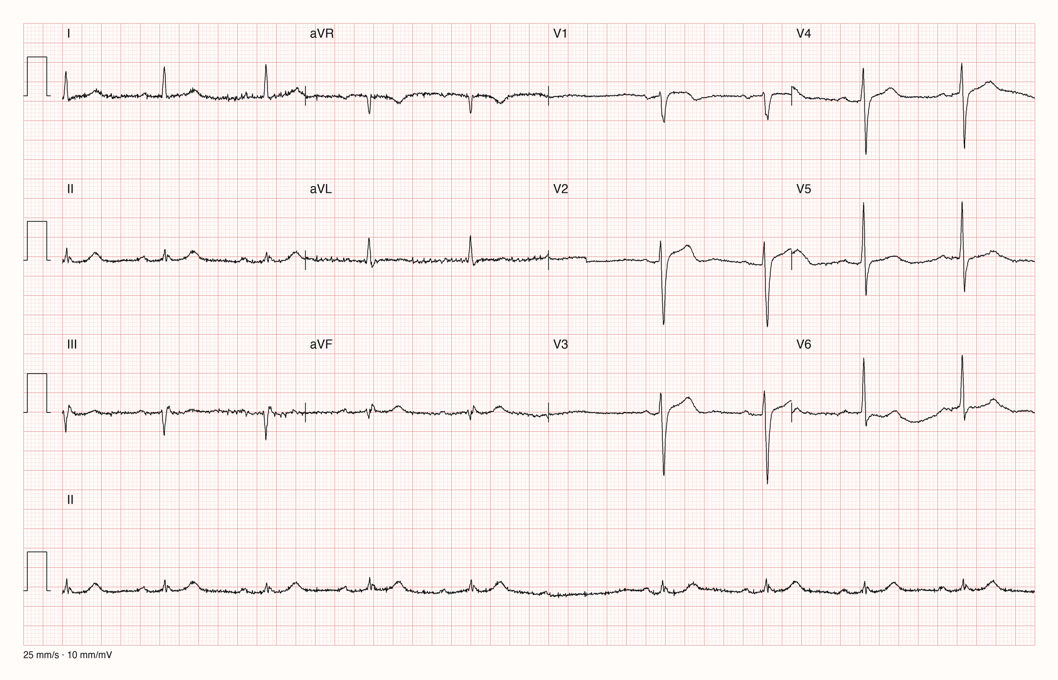 12-Kanal-EKG JS12426; zur systematischen Befundung