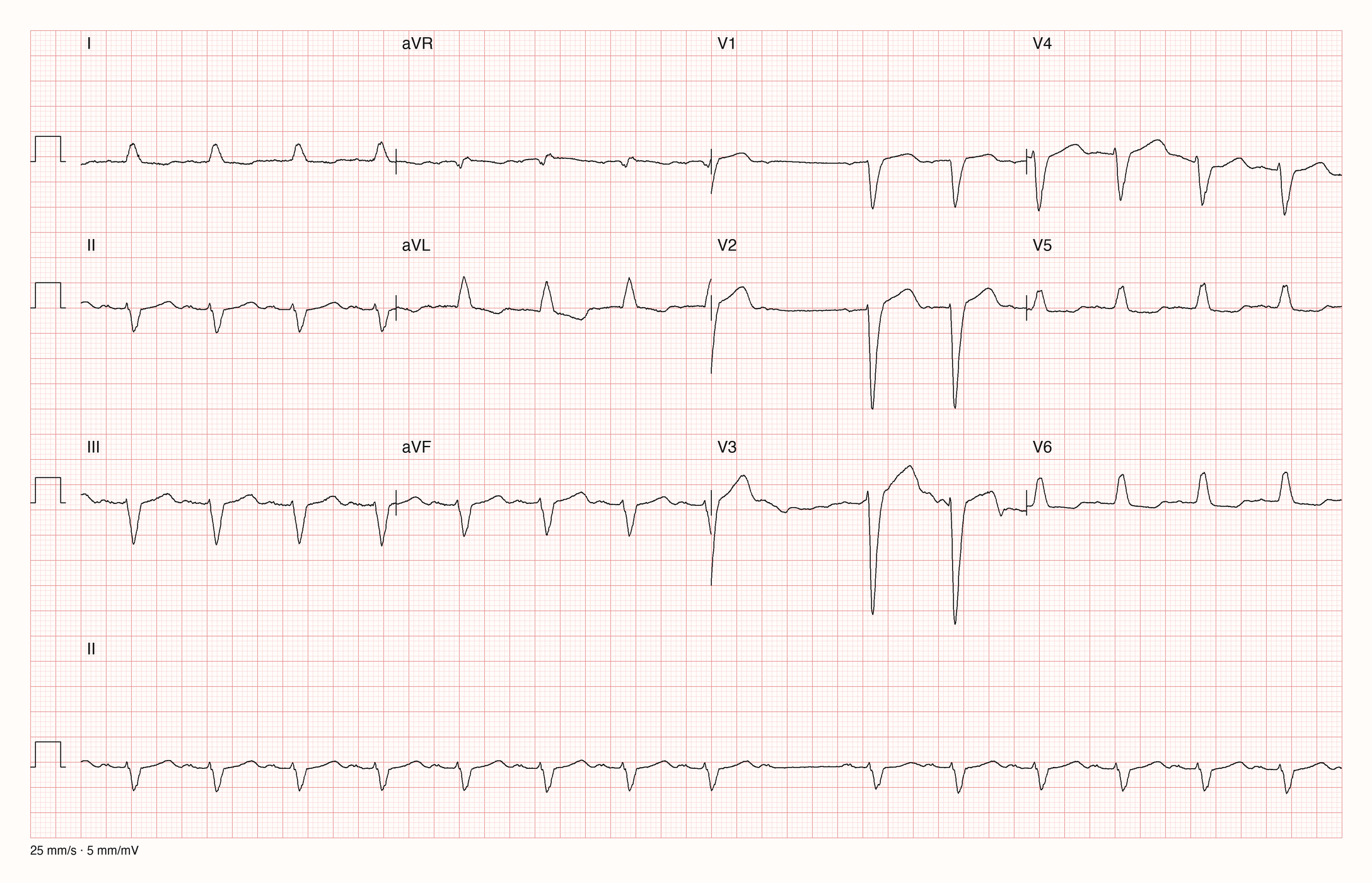 12-Kanal-EKG JS12438; zur systematischen Befundung