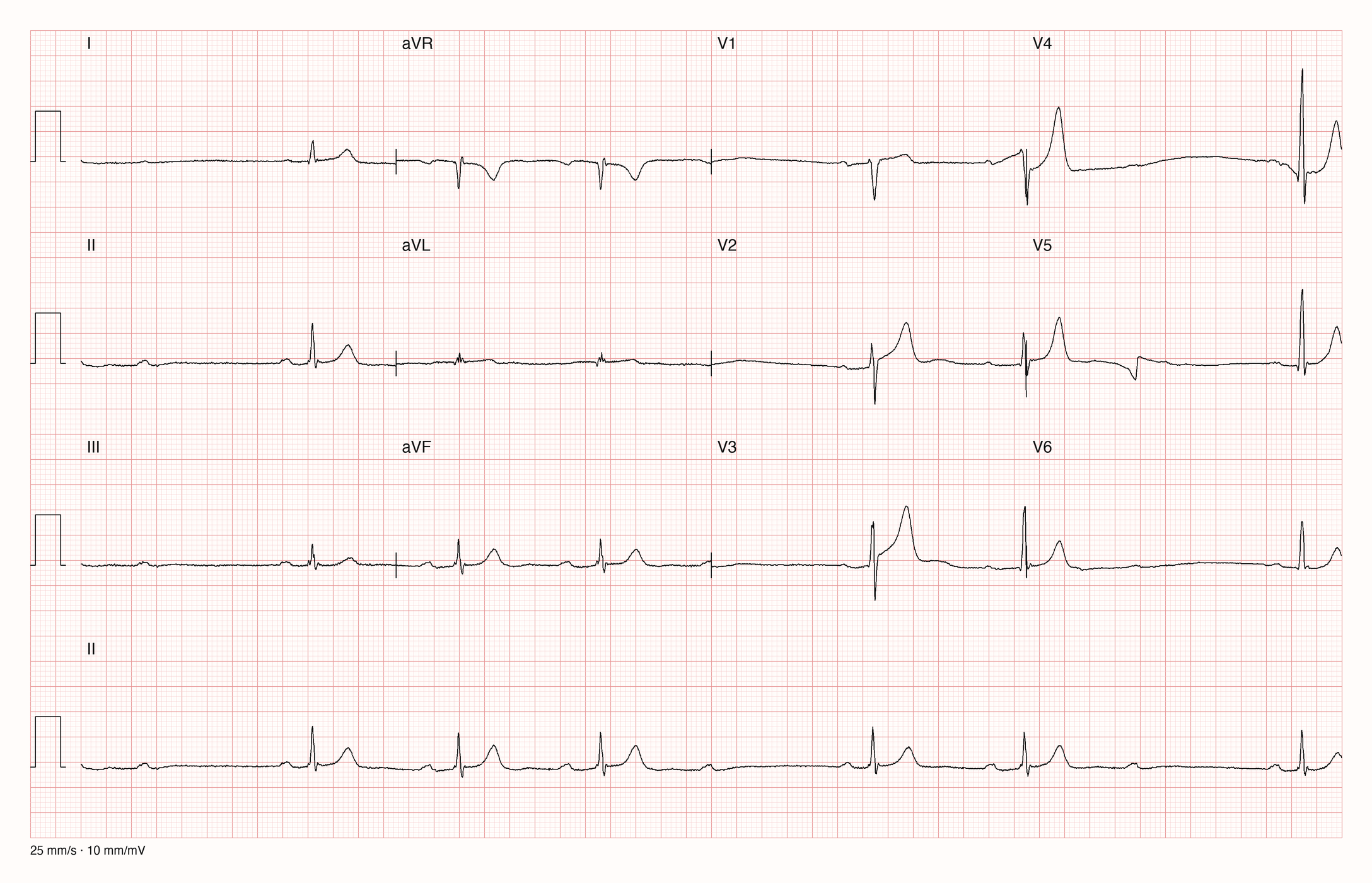 12-Kanal-EKG JS12440; zur systematischen Befundung