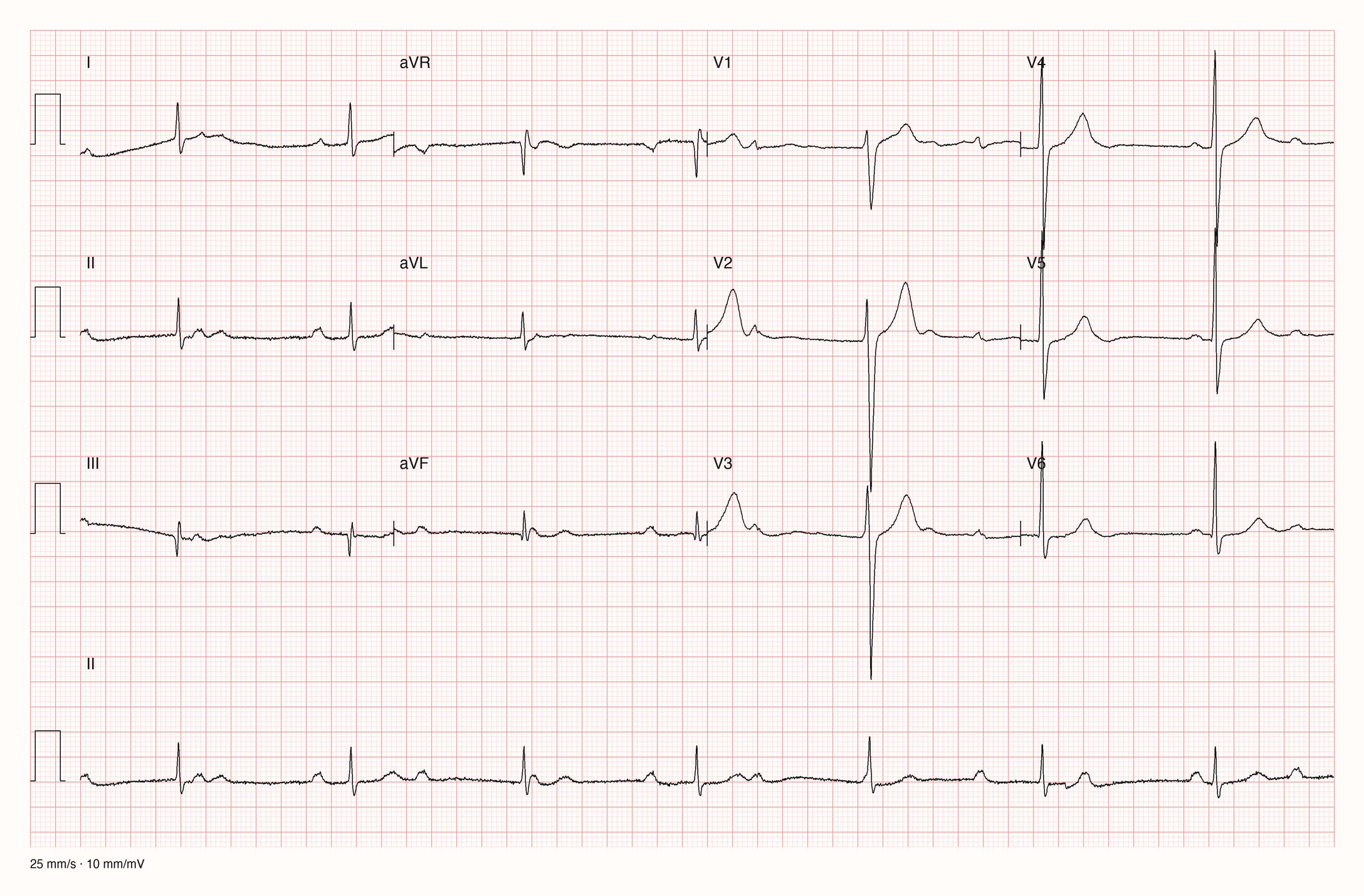 12-Kanal-EKG JS12506; zur systematischen Befundung