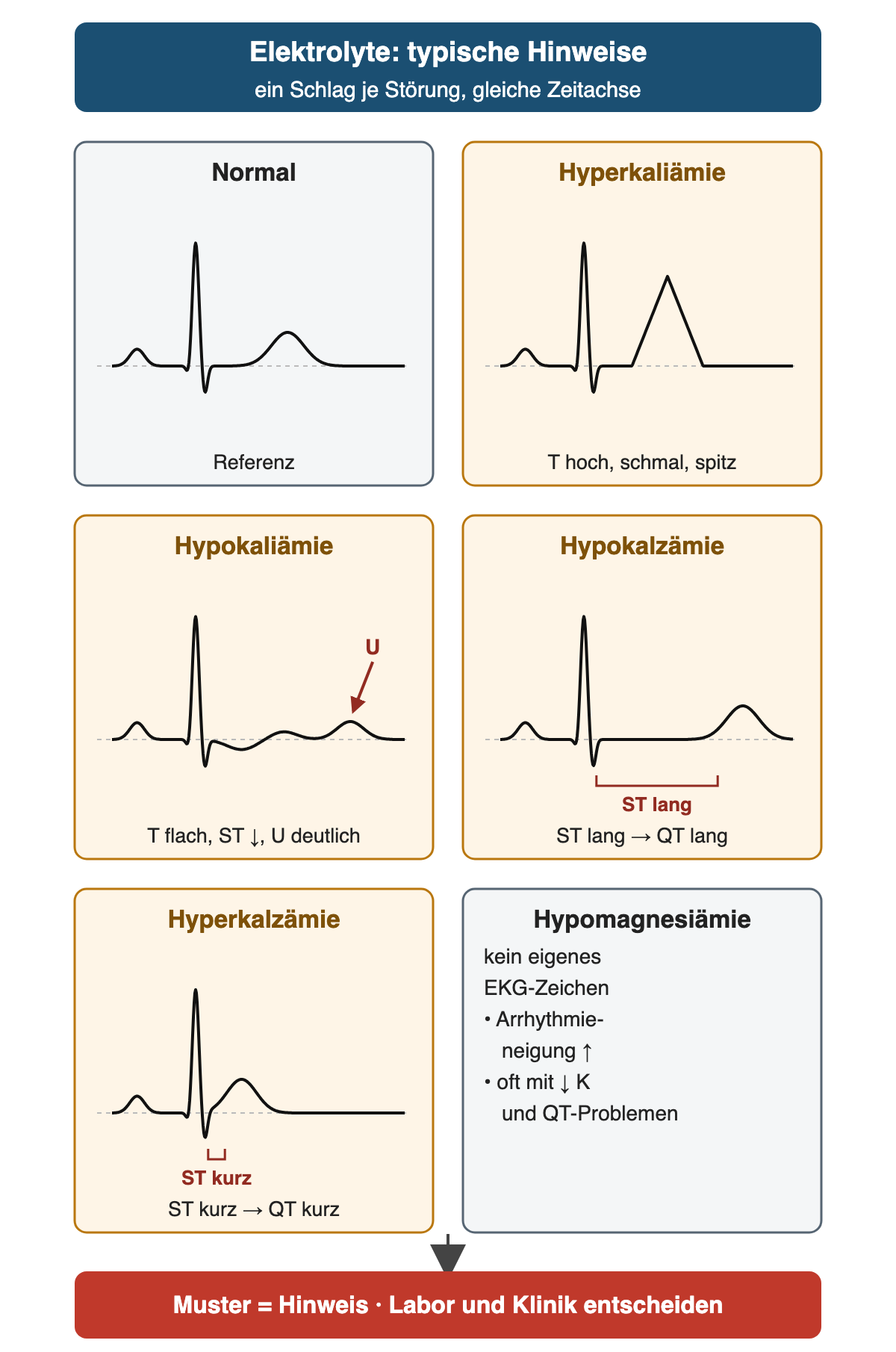 Sechs Felder mit je einem schematischen Schlag: normal als Referenz; Hyperkaliämie mit hoher, schmaler, spitzer T-Welle; Hypokaliämie mit flachem T, leichter ST-Senkung und deutlicher U-Welle; Hypokalzämie mit langer isoelektrischer ST-Strecke und dadurch langem QT; Hyperkalzämie mit sehr kurzer ST-Strecke und kurzem QT; Hypomagnesiämie ohne eigenes EKG-Zeichen, aber mit Arrhythmieneigung, oft zusammen mit niedrigem Kalium und QT-Problemen. Ergebnis: Das Muster ist ein Hinweis, Labor und Klinik entscheiden