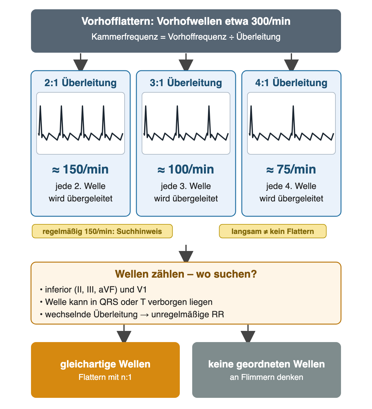 Vorhofflattern mit etwa 300 Vorhofwellen pro Minute: bei 2:1-Überleitung etwa 150/min, bei 3:1 etwa 100/min, bei 4:1 etwa 75/min Kammerfrequenz; schematische Streifen mit negativem Sägezahn und schmalem QRS nach jeder 2., 3. bzw. 4. Welle; Wellen inferior und in V1 suchen