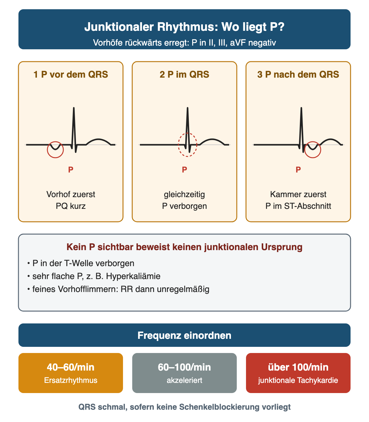 Drei schematische Komplexe in Ableitung II mit negativer P-Welle kurz vor dem QRS, im QRS verborgen und nach dem QRS im ST-Abschnitt; darunter drei Gründe, warum eine fehlende P-Welle keinen junktionalen Ursprung beweist, und die Frequenzbereiche 40–60/min Ersatzrhythmus, 60–100/min akzeleriert und über 100/min junktionale Tachykardie
