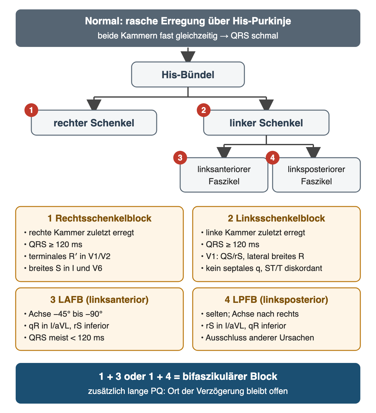 Leitungssystem als Baum: His-Bündel, rechter und linker Schenkel, linksanteriorer und linksposteriorer Faszikel; vier nummerierte Blockorte mit ihren EKG-Zeichen, unten bifaszikulärer Block als Kombination