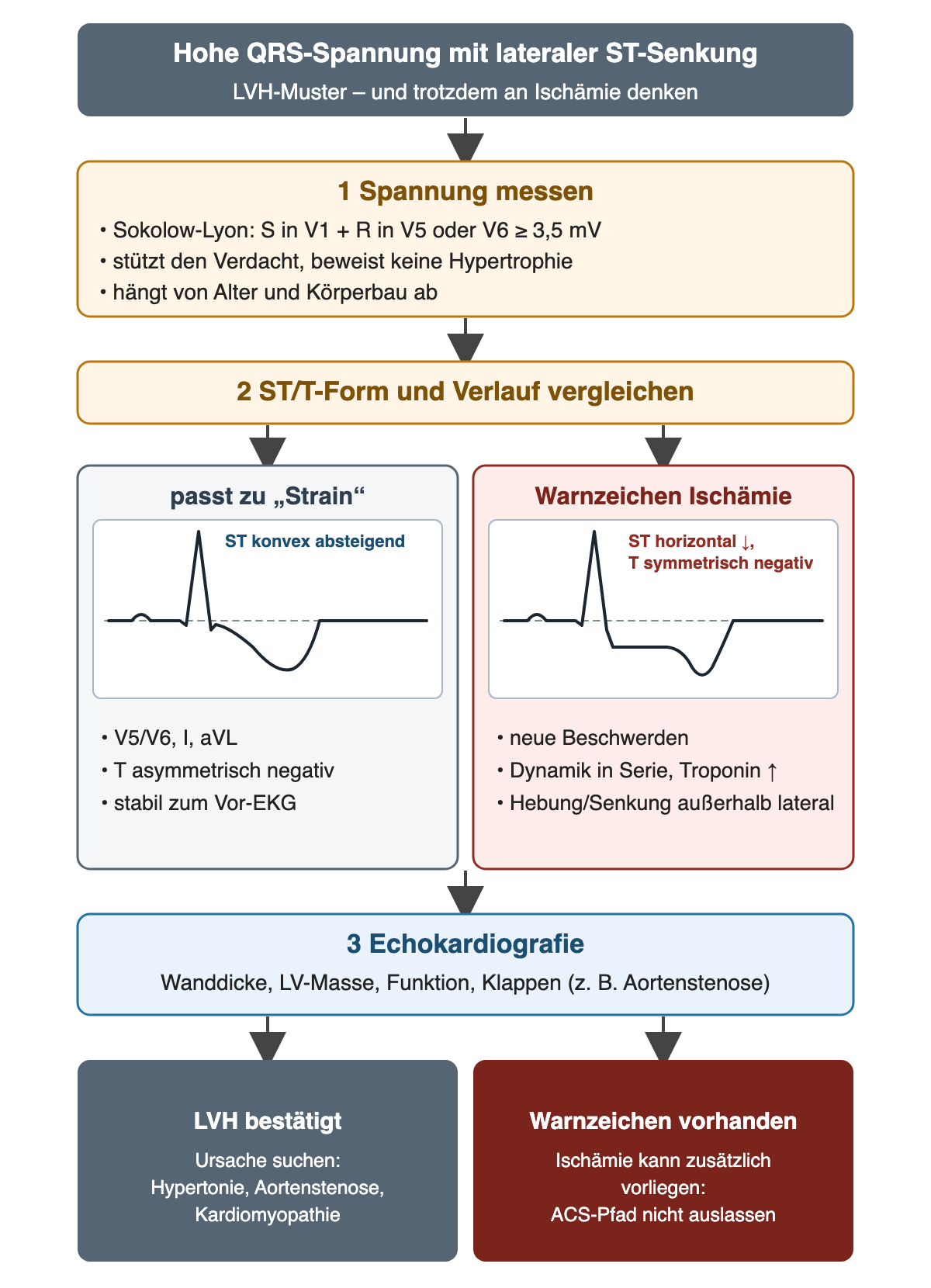 Ablaufdiagramm LVH-Muster: 1 Spannung nach Sokolow-Lyon messen, 2 ST/T-Form und Verlauf vergleichen mit schematischem Strain-Komplex (konvex absteigende ST-Senkung, asymmetrisch negatives T) neben einem Ischämie-Komplex (horizontale ST-Senkung, symmetrisch negatives T), 3 Echokardiografie; Ausgänge LVH bestätigt oder Warnzeichen mit ACS-Pfad