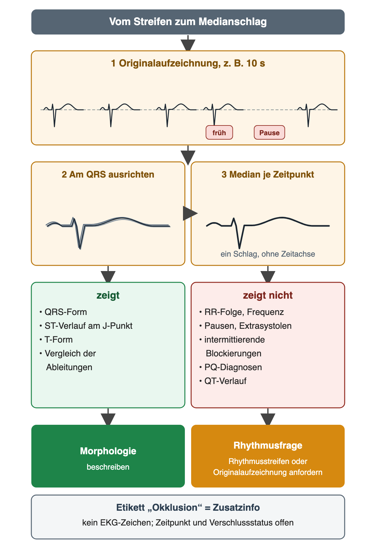 Ablauf vom Originalstreifen mit vorzeitigem Schlag und Pause über das Übereinanderlegen der Schläge am QRS zum einzelnen Medianschlag; darunter, was der Medianschlag zeigt und was nicht, und die Folgerungen