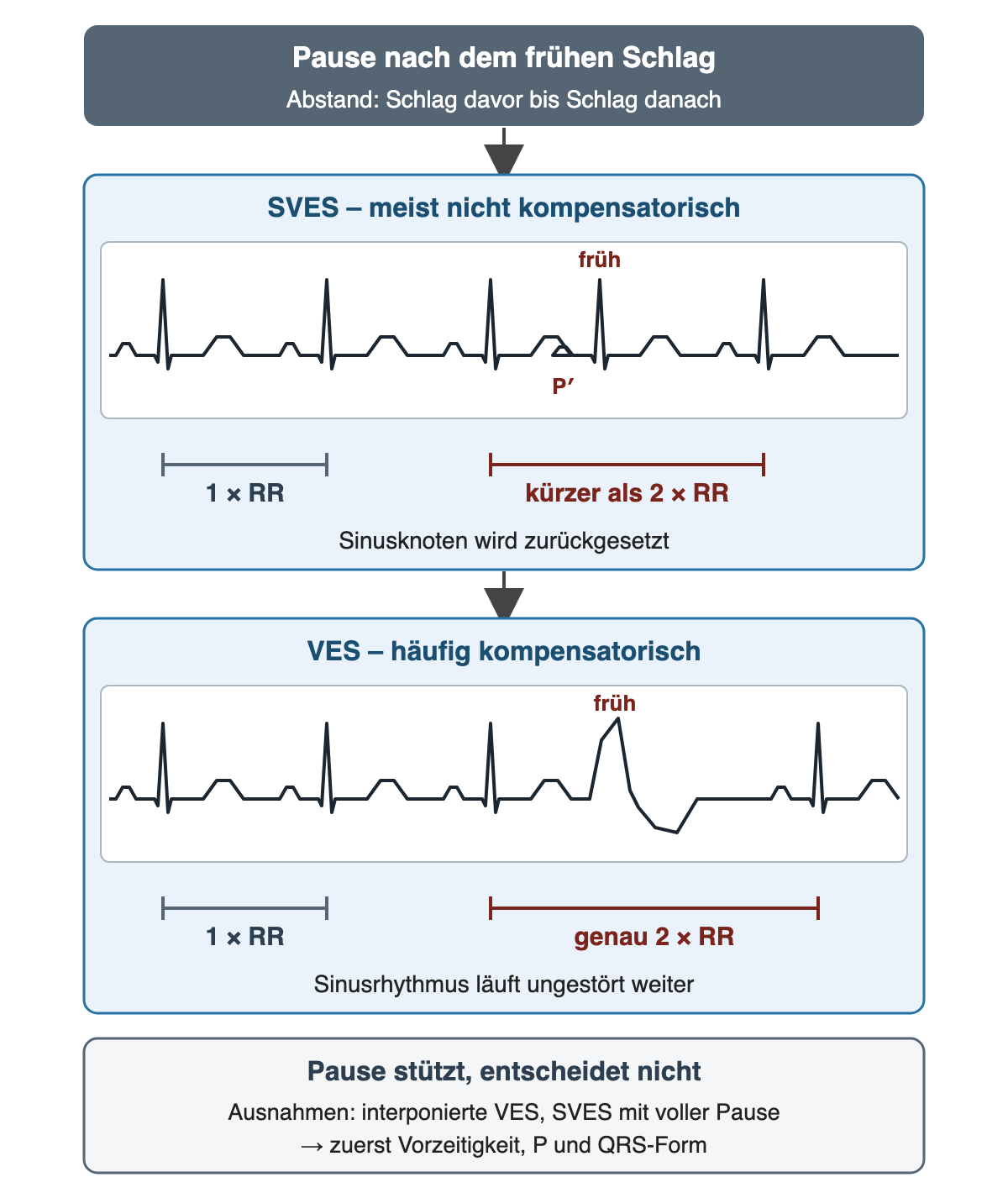 Pause nach dem frühen Schlag, schematisch: bei der SVES wird der Sinusknoten zurückgesetzt, der Abstand vom Schlag davor bis zum Schlag danach ist kürzer als zwei Grund-RR; bei der VES läuft der Sinusrhythmus weiter, der Abstand beträgt genau zwei Grund-RR; Ausnahmen interponierte VES und SVES mit voller Pause