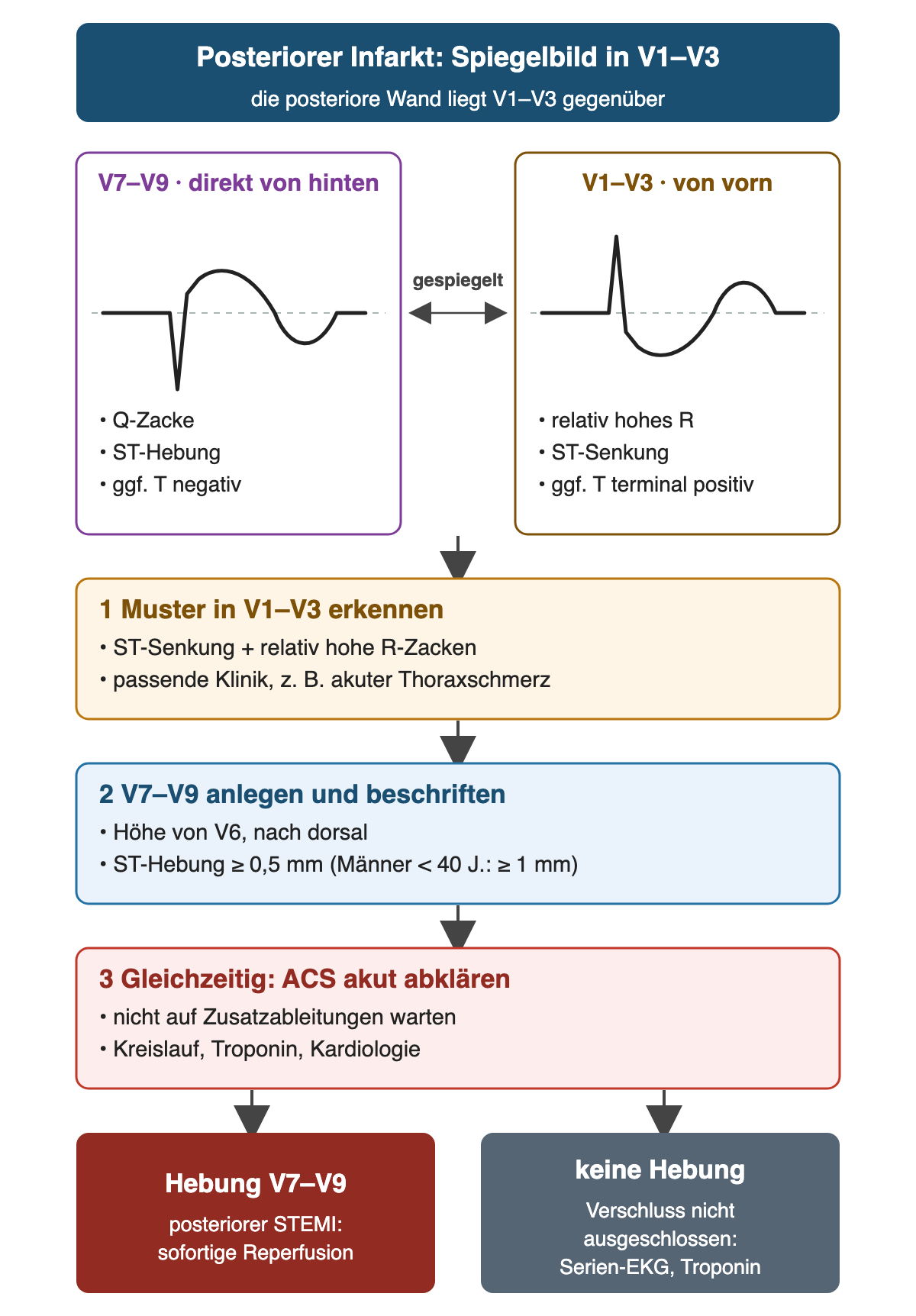 Spiegelprinzip beim posterioren Infarkt: links der direkte Blick von hinten (V7–V9) mit Q-Zacke, ST-Hebung und gegebenenfalls negativem T, rechts derselbe Komplex gespiegelt in V1–V3 mit relativ hohem R, ST-Senkung und gegebenenfalls terminal positivem T. Darunter drei Schritte: Muster erkennen, V7–V9 anlegen und beschriften (ST-Hebung ab 0,5 mm, bei Männern unter 40 Jahren ab 1 mm), gleichzeitig ACS akut abklären. Ergebnis: Hebung in V7–V9 als posteriorer STEMI mit sofortiger Reperfusion; ohne Hebung ist ein Verschluss nicht ausgeschlossen