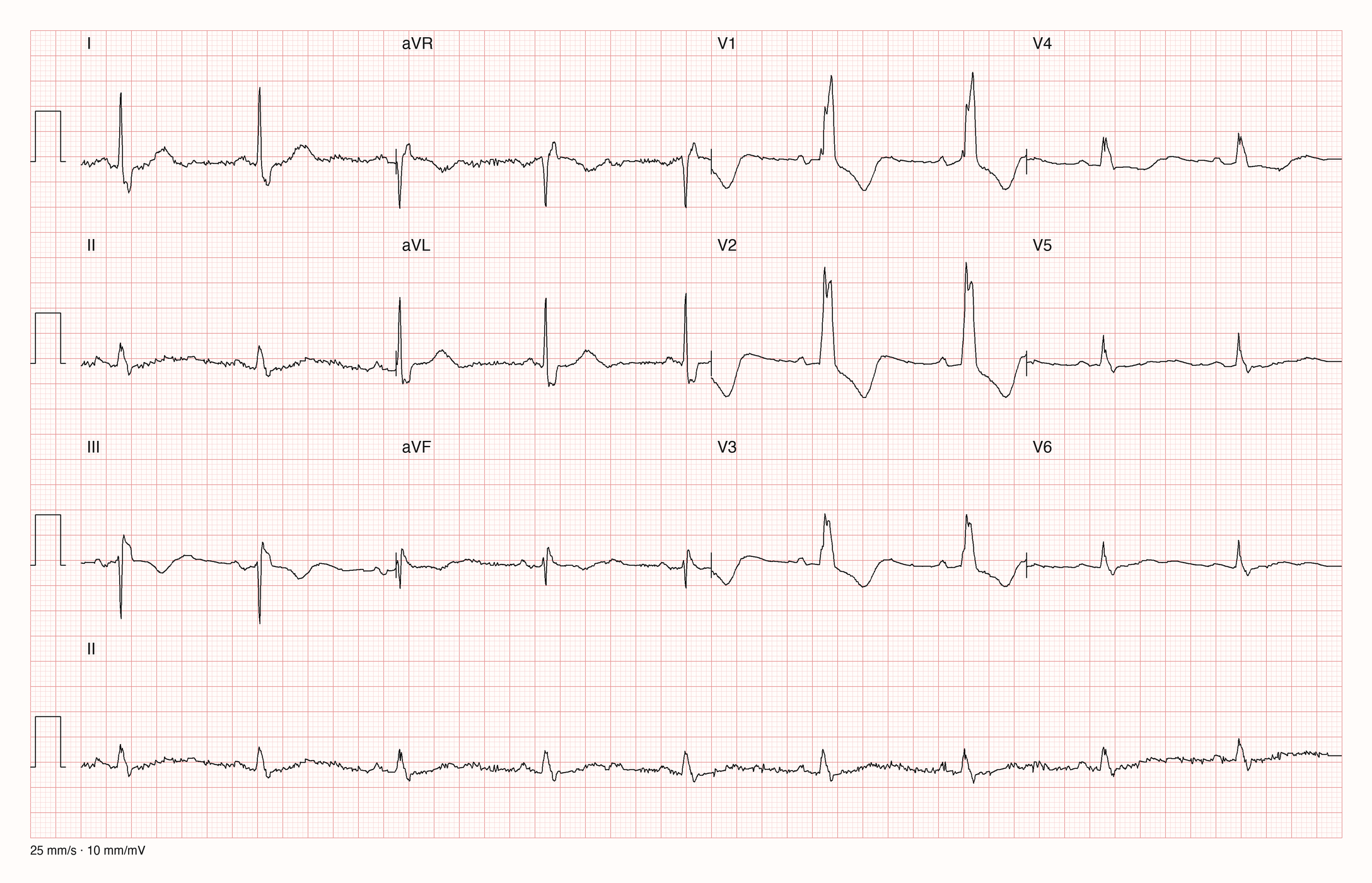 12-Kanal-EKG 10003; zur systematischen Befundung