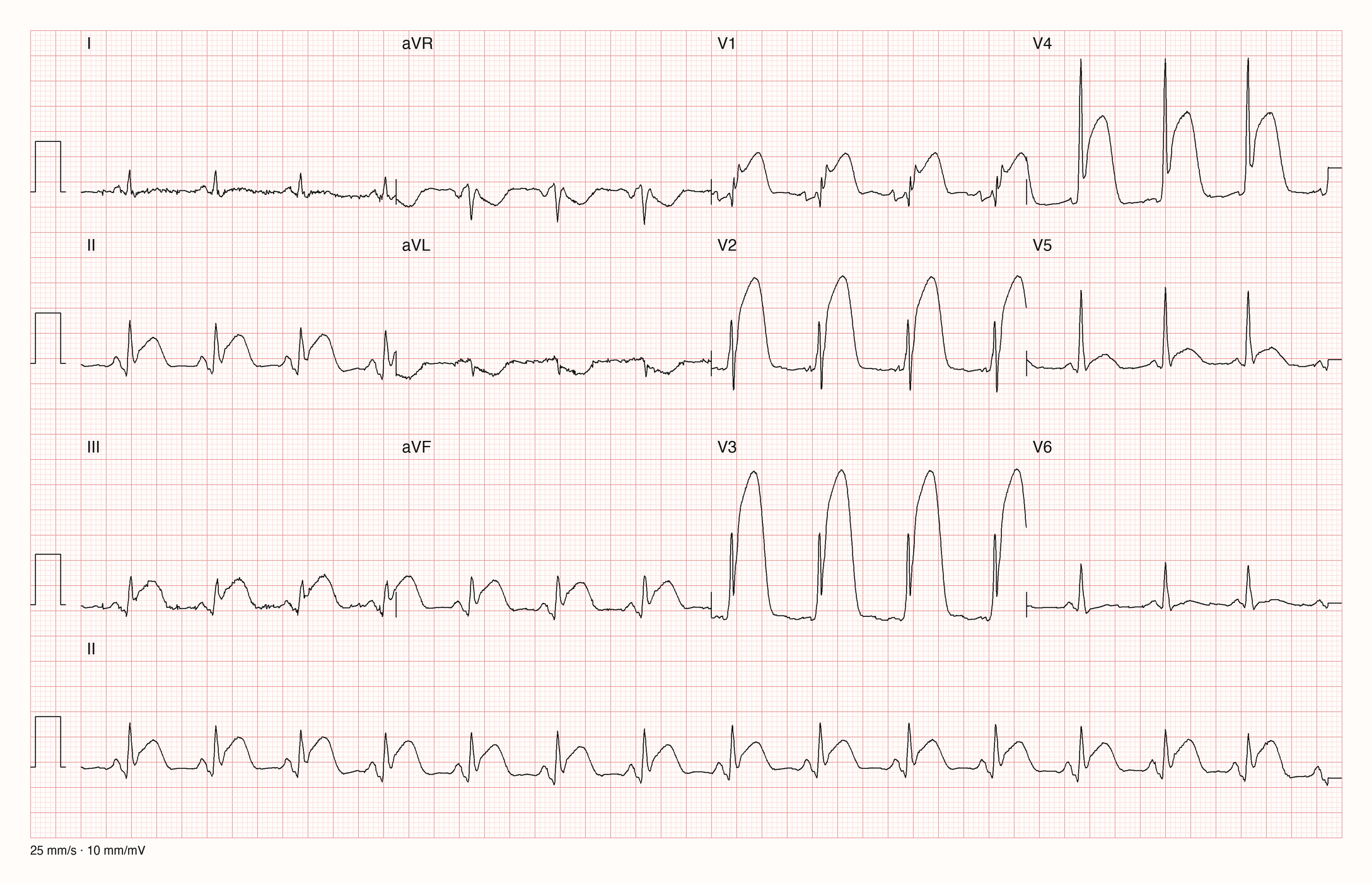 12-Kanal-EKG 1063; zur systematischen Befundung
