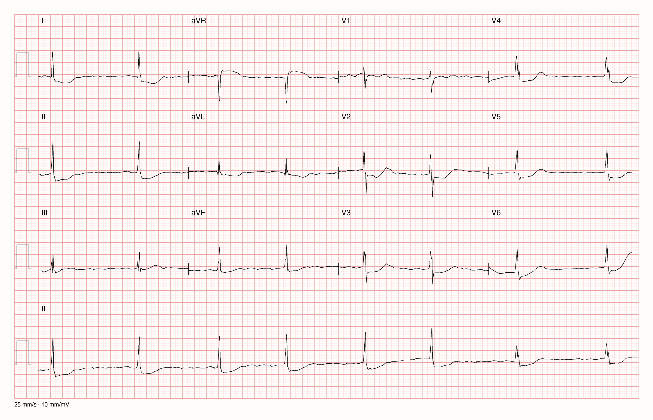 12-Kanal-EKG 1065; zur systematischen Befundung