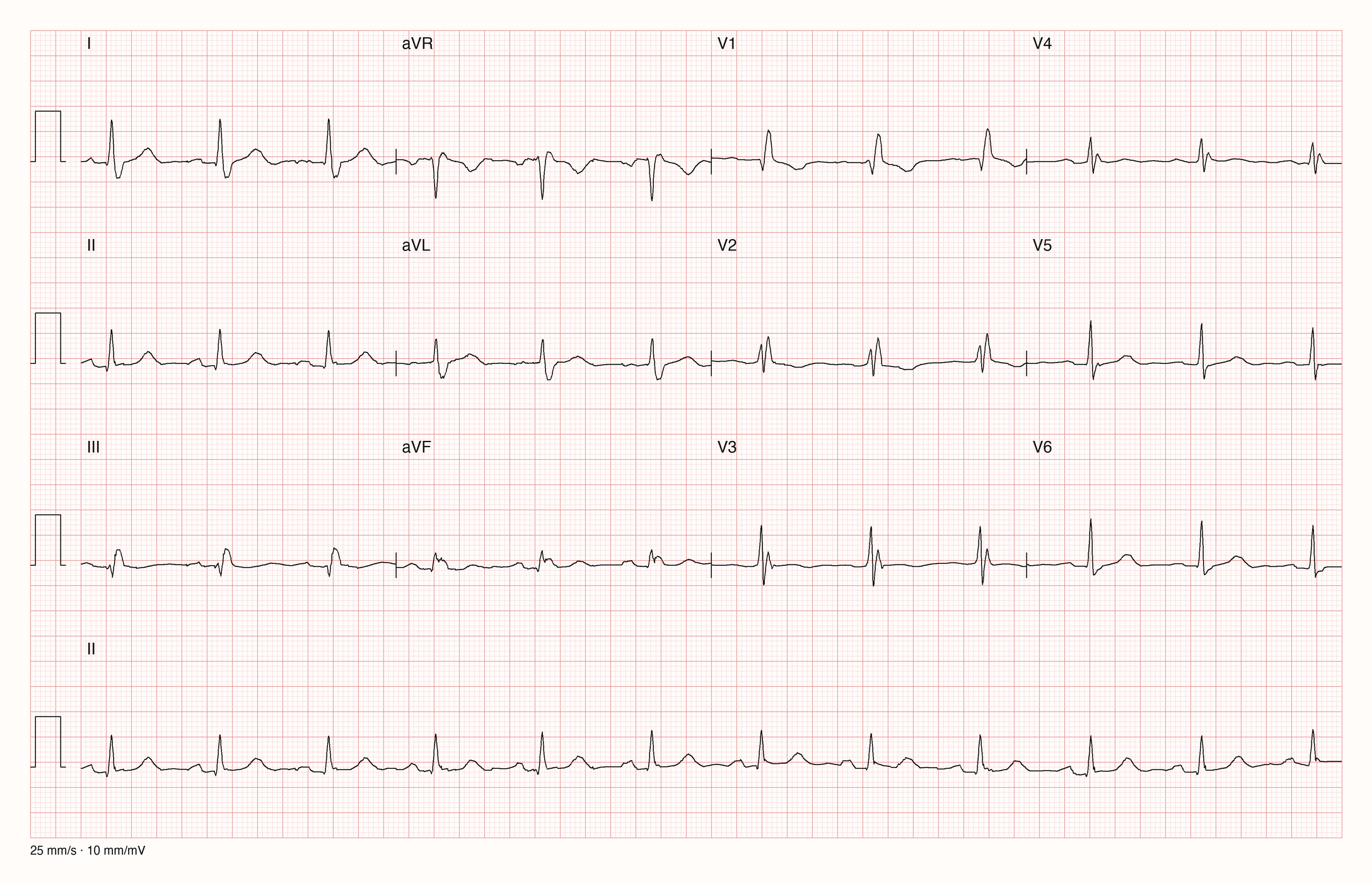 12-Kanal-EKG 1123; zur systematischen Befundung