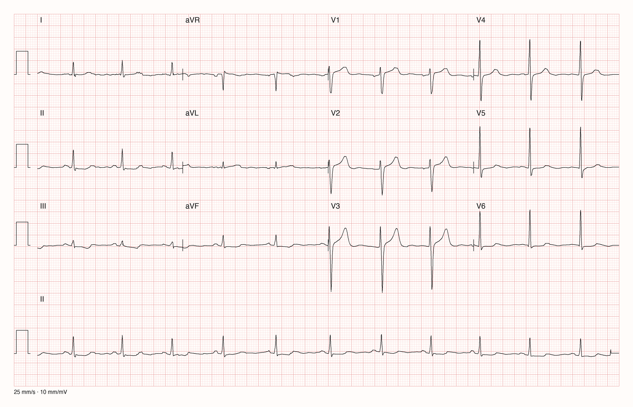 12-Kanal-EKG 1175; zur systematischen Befundung