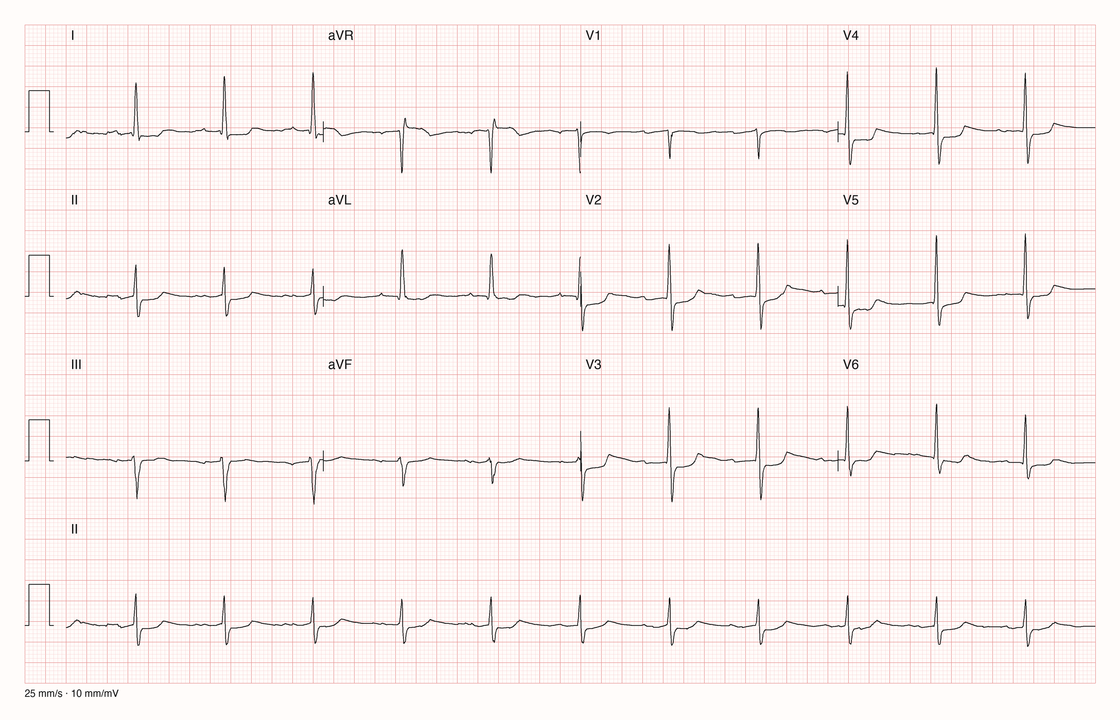 12-Kanal-EKG 11860; zur systematischen Befundung