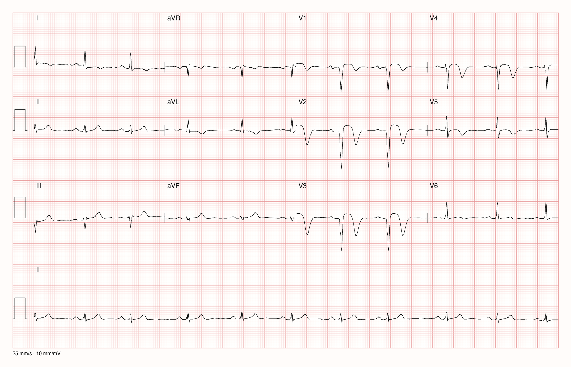 12-Kanal-EKG 11944; zur systematischen Befundung