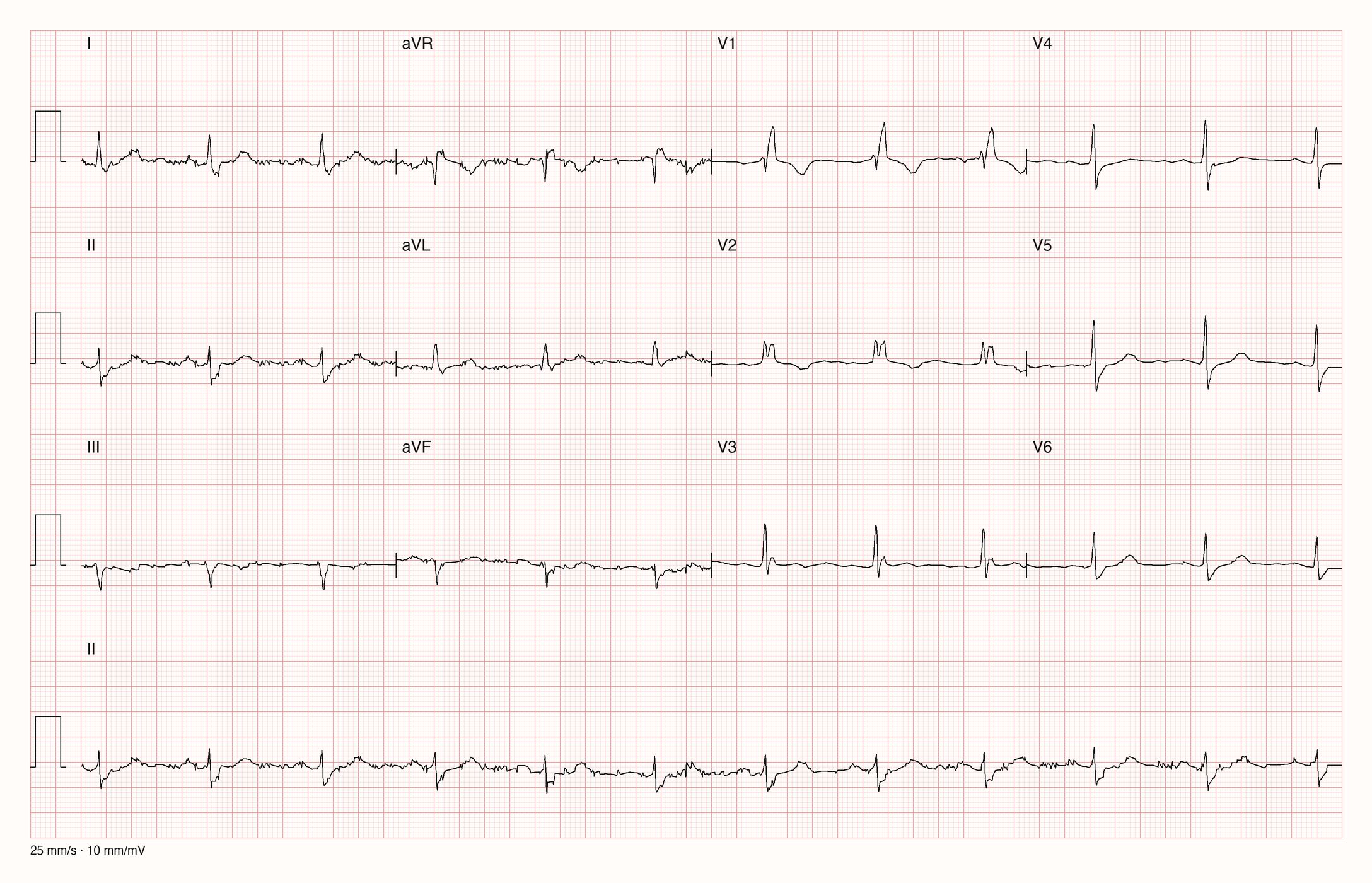 12-Kanal-EKG 12552; zur systematischen Befundung