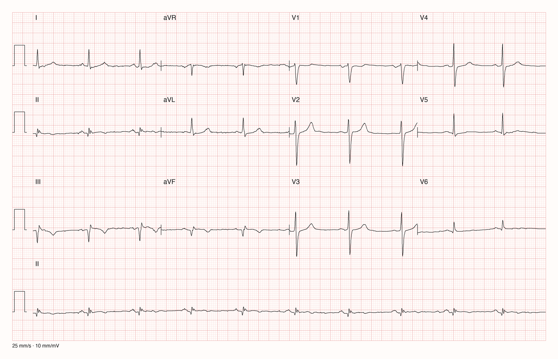 12-Kanal-EKG 12841; zur systematischen Befundung