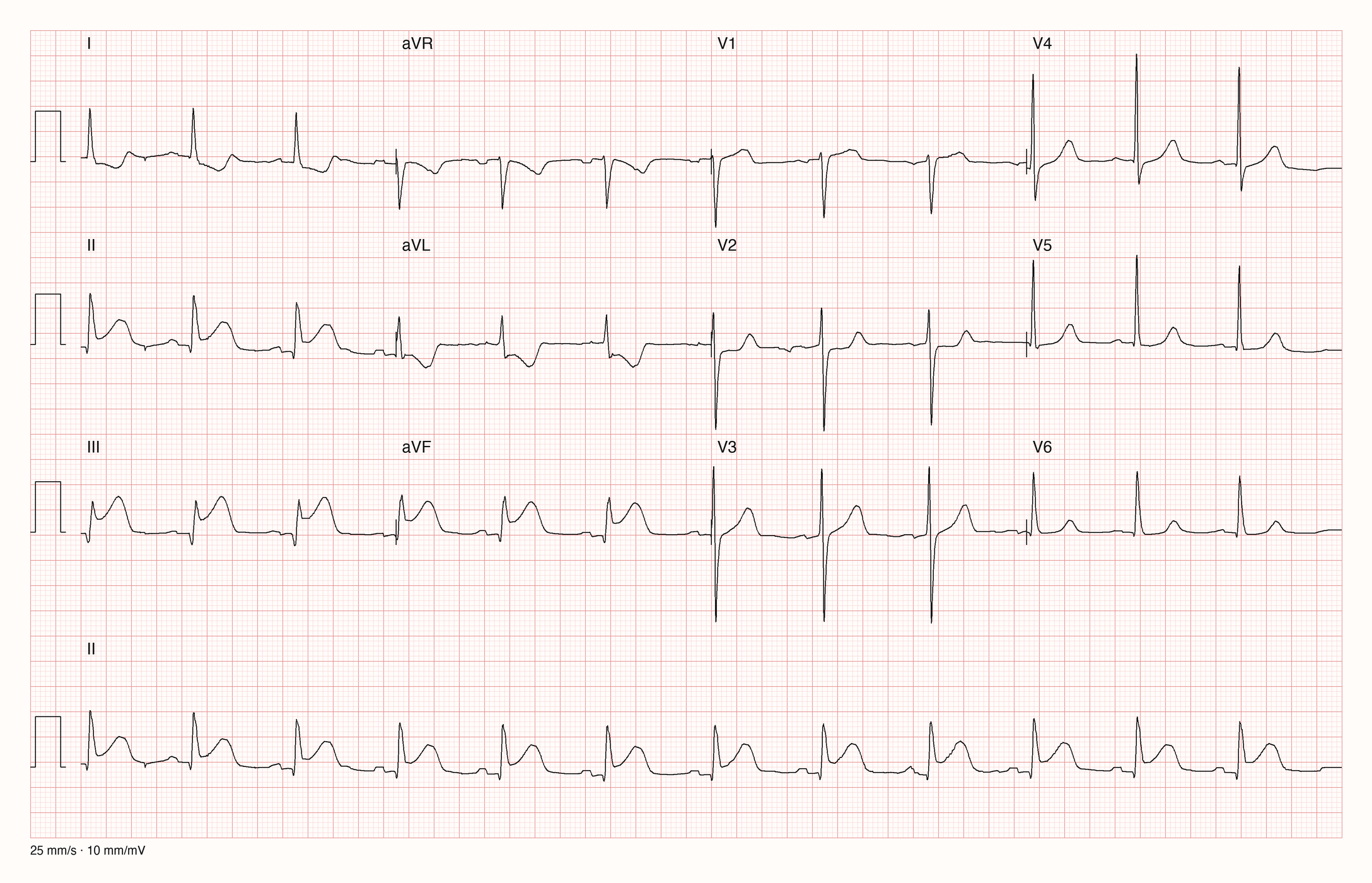 12-Kanal-EKG 12899; zur systematischen Befundung
