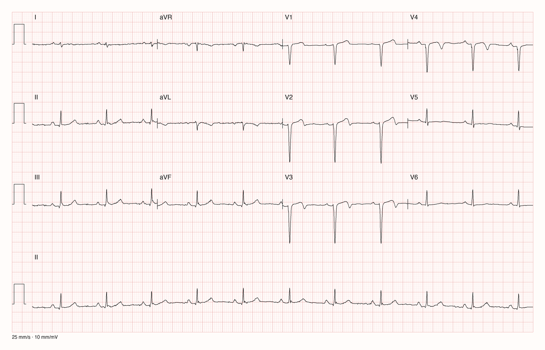 12-Kanal-EKG 1440; zur systematischen Befundung