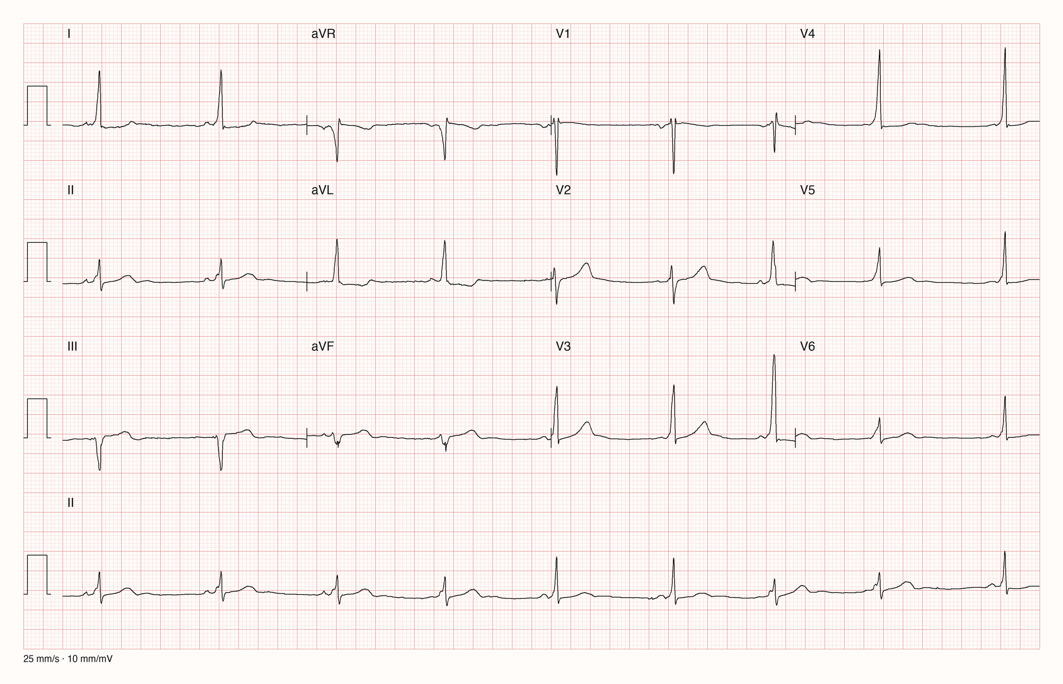 12-Kanal-EKG 14653; zur systematischen Befundung