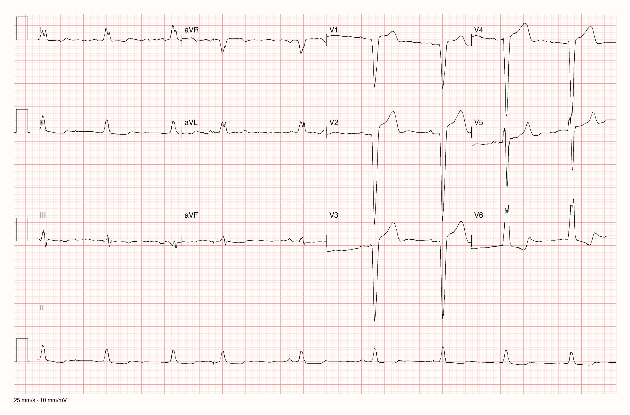 12-Kanal-EKG 1564; zur systematischen Befundung